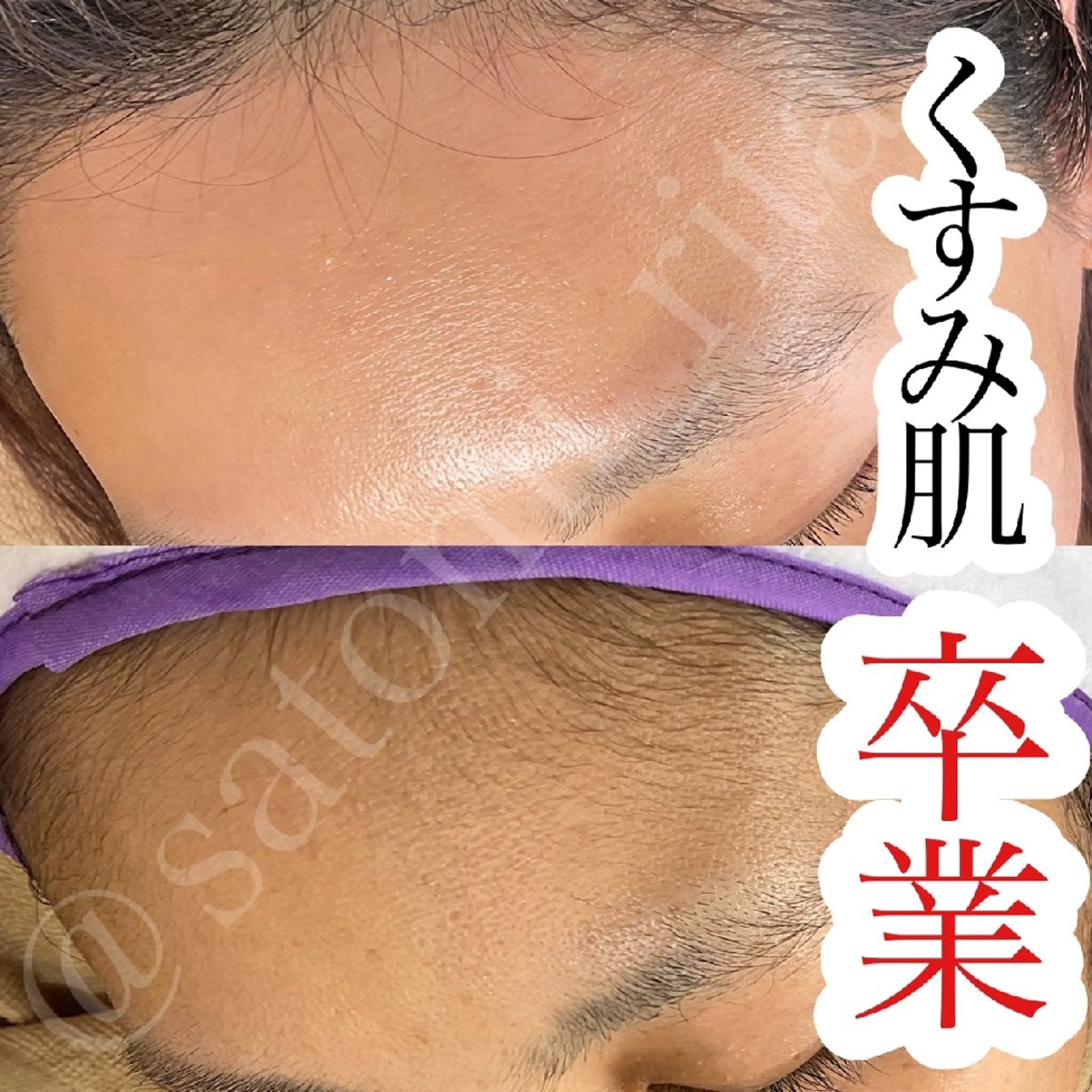 脱毛 Rita eyelash＆waxing所属・Rita eye&waxのその他イメージ