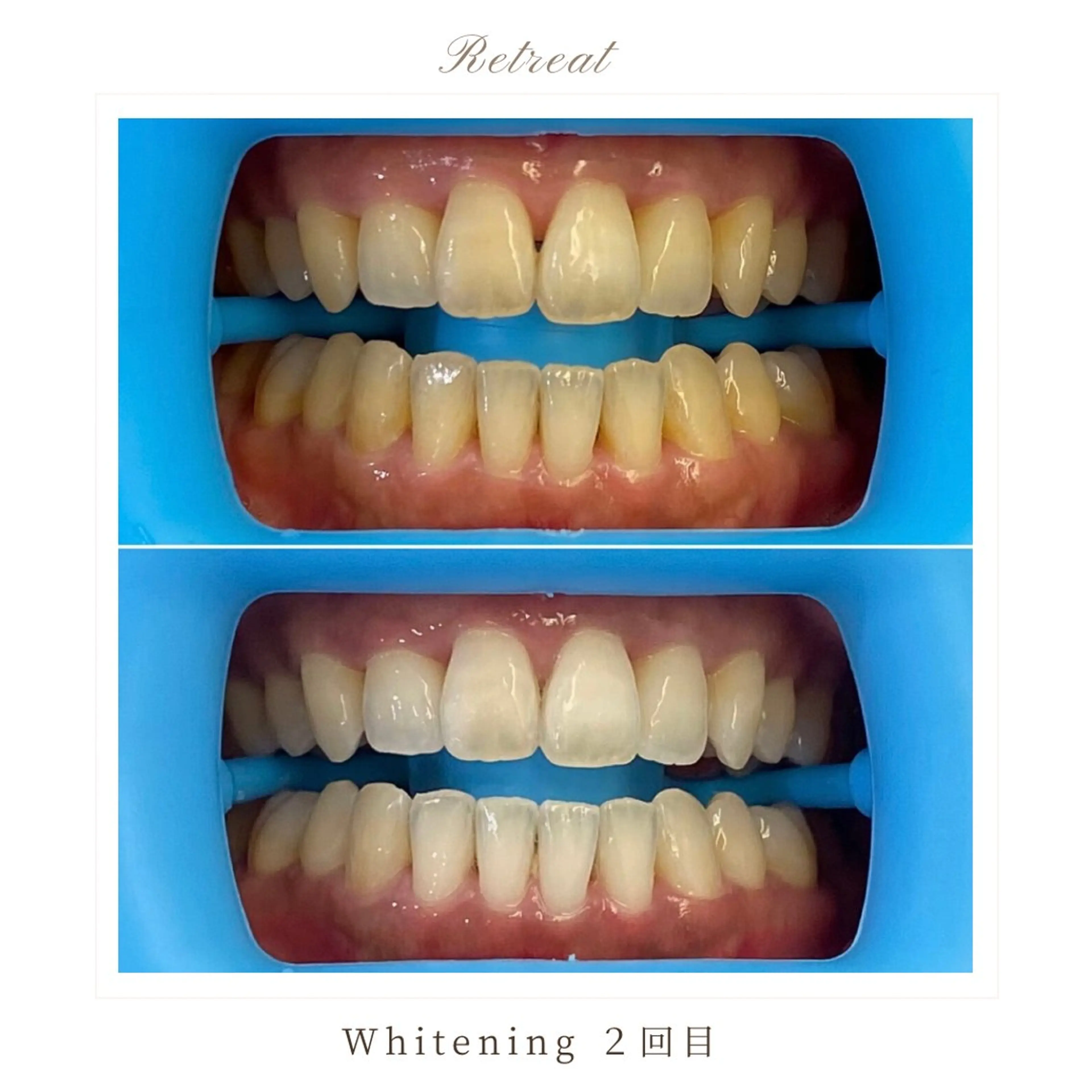 歯科医院提携 Retreatのエステ・リラクイメージ