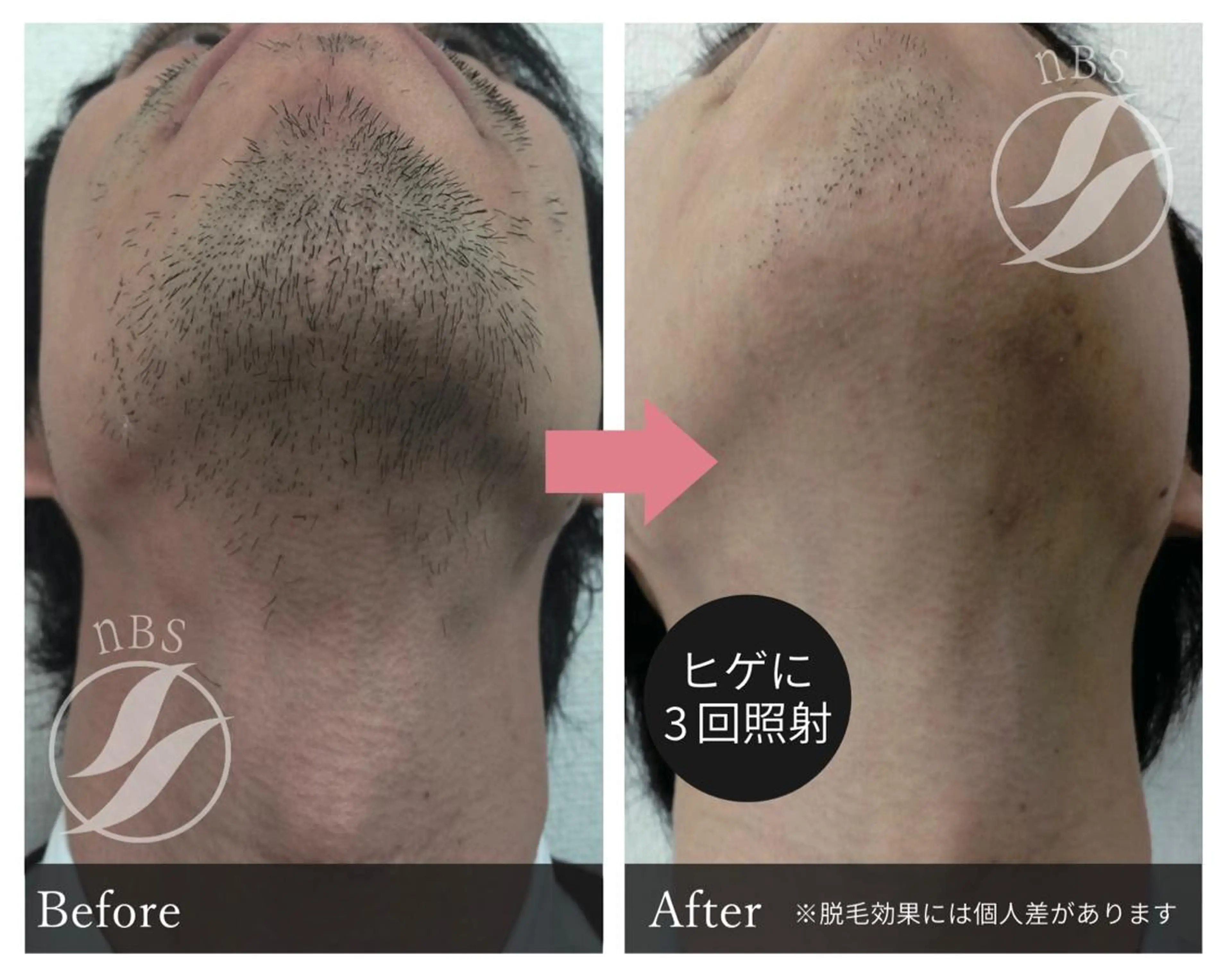 メンズ ARME 浅見のエステ・リラクイメージ