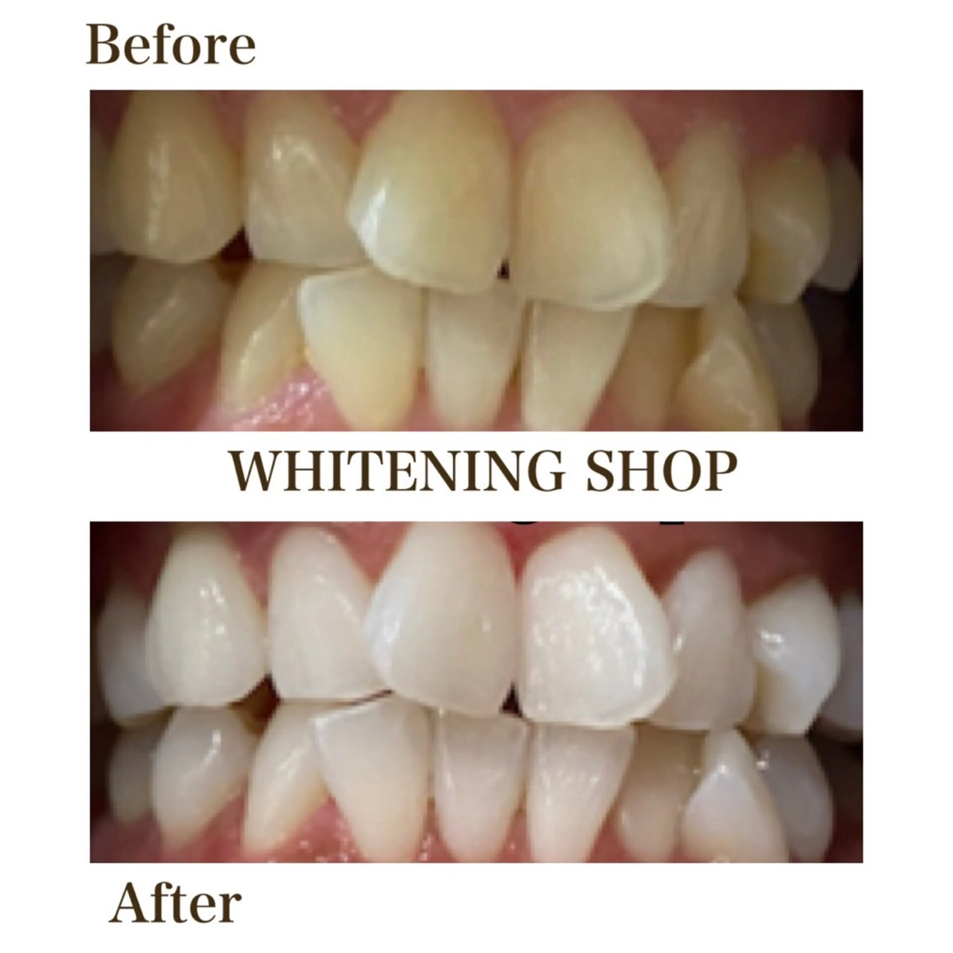 エステ リラク ホワイトニング ショップ川越店のエステ・リラクイメージ