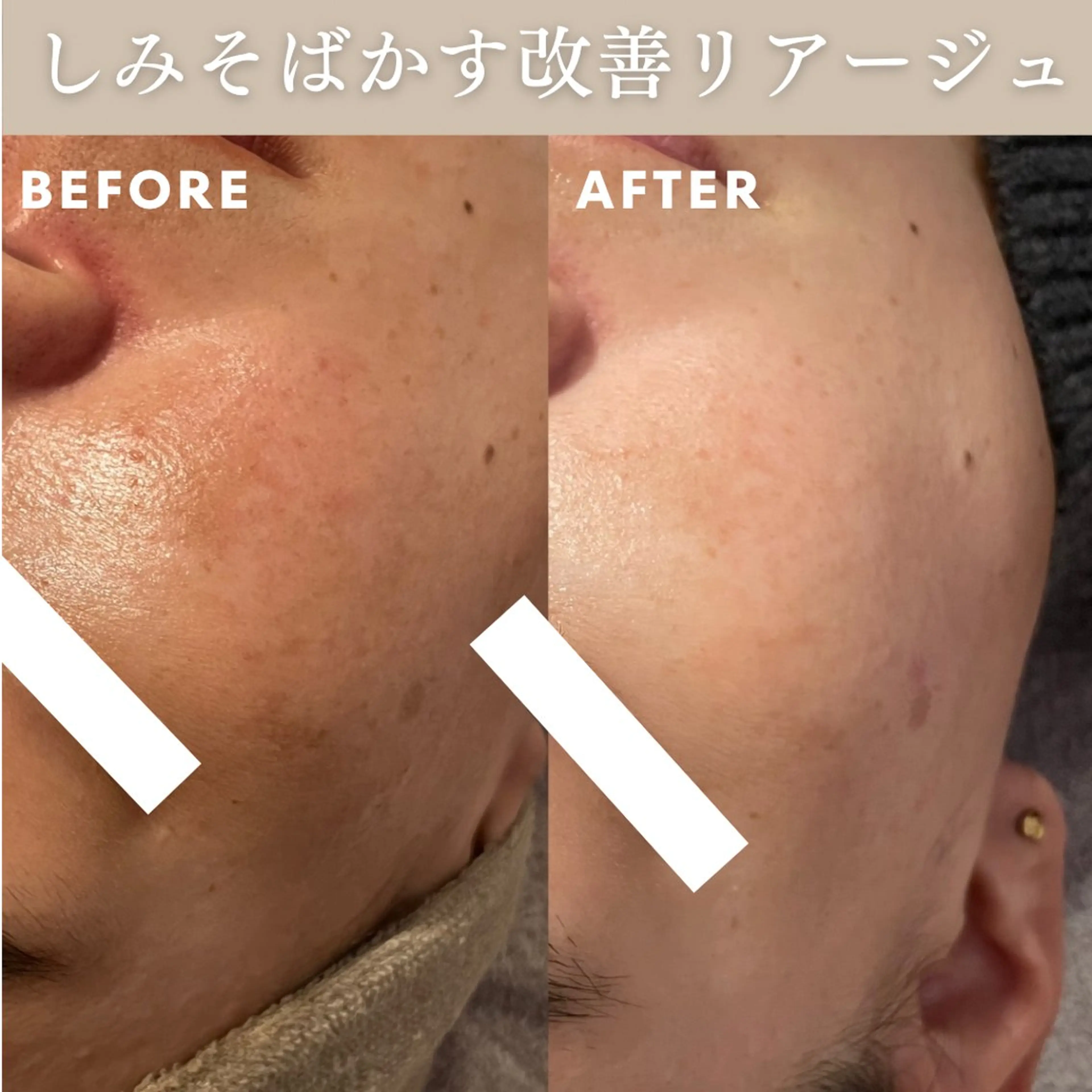 エステ Lassy Yuriの眉毛・アイブロウイメージ