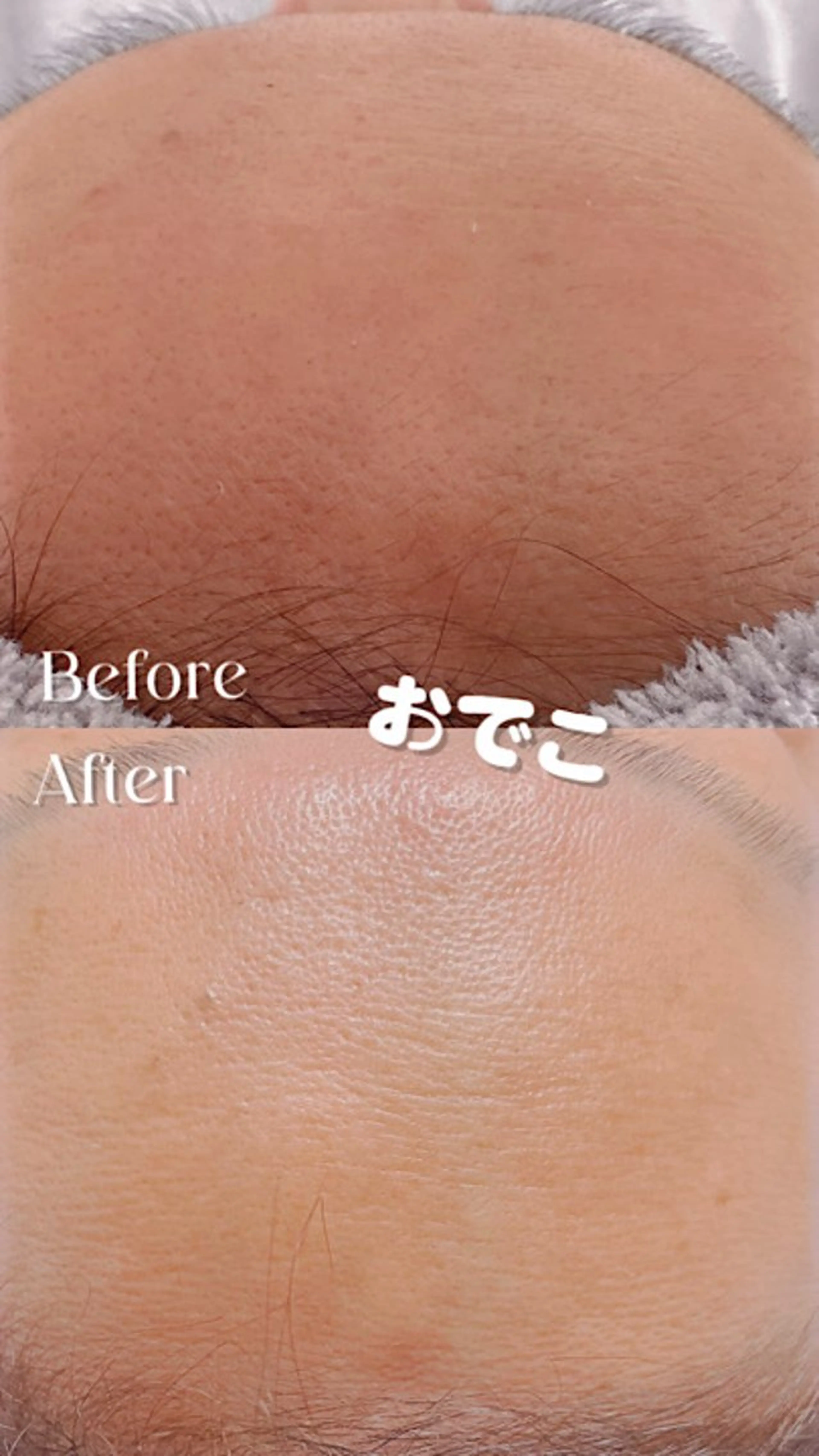 Hitomi シュガーリング豊橋のその他イメージ