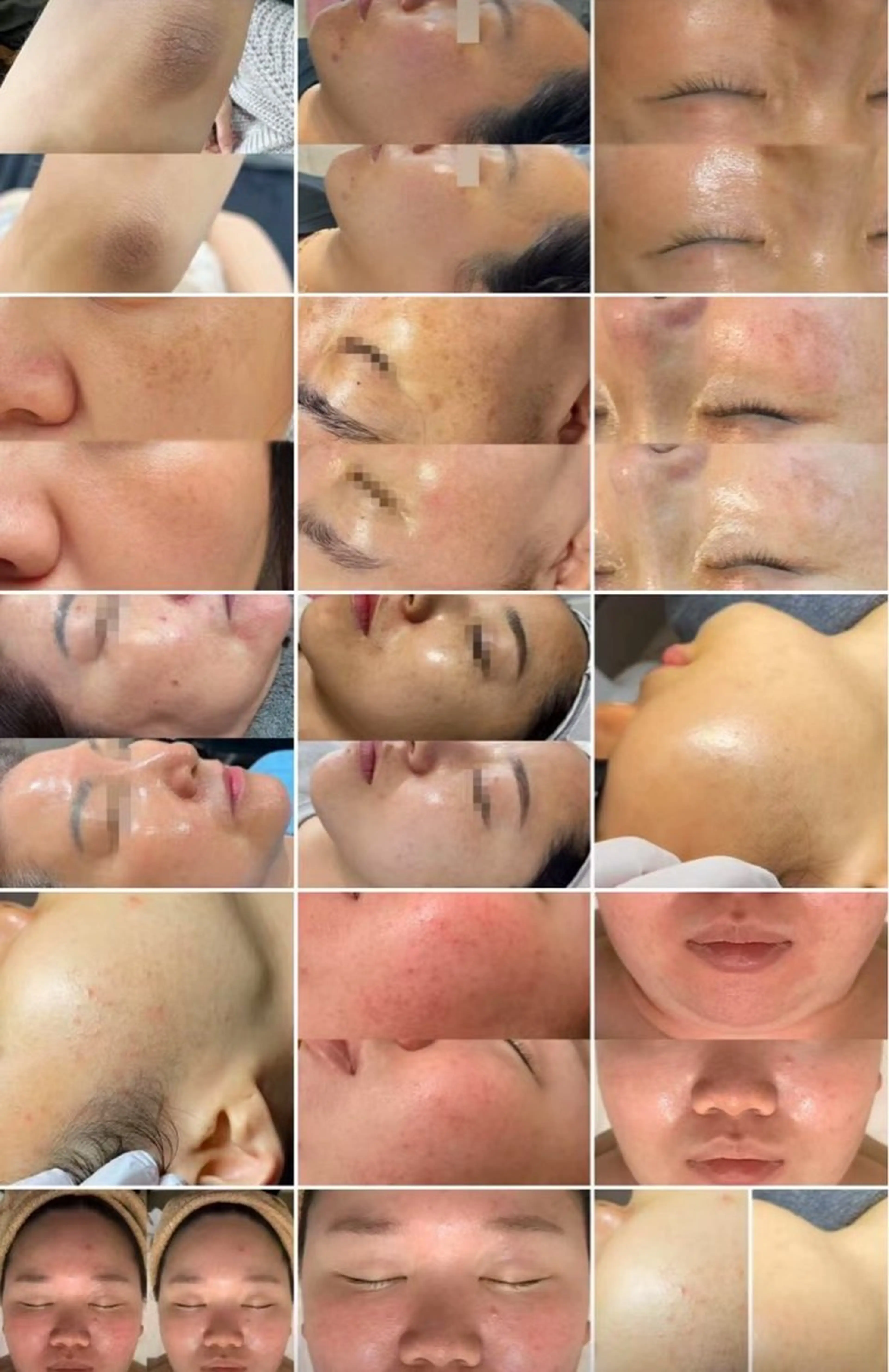 マツエク・マツパ aliaハーブ水光店 エステティシャン募集のエステ・リラクイメージ