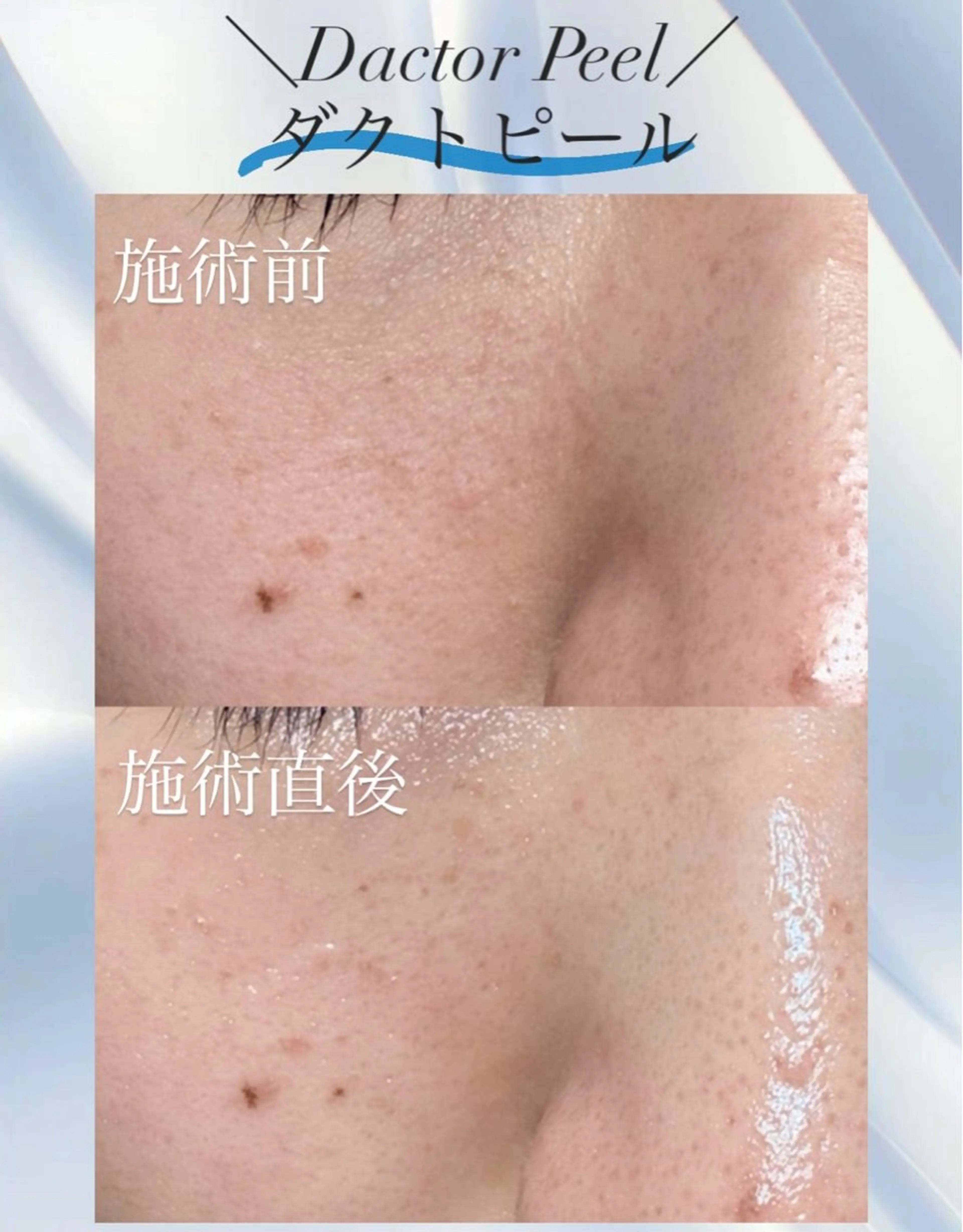 エステ salon de AZUREのエステ・リラクイメージ