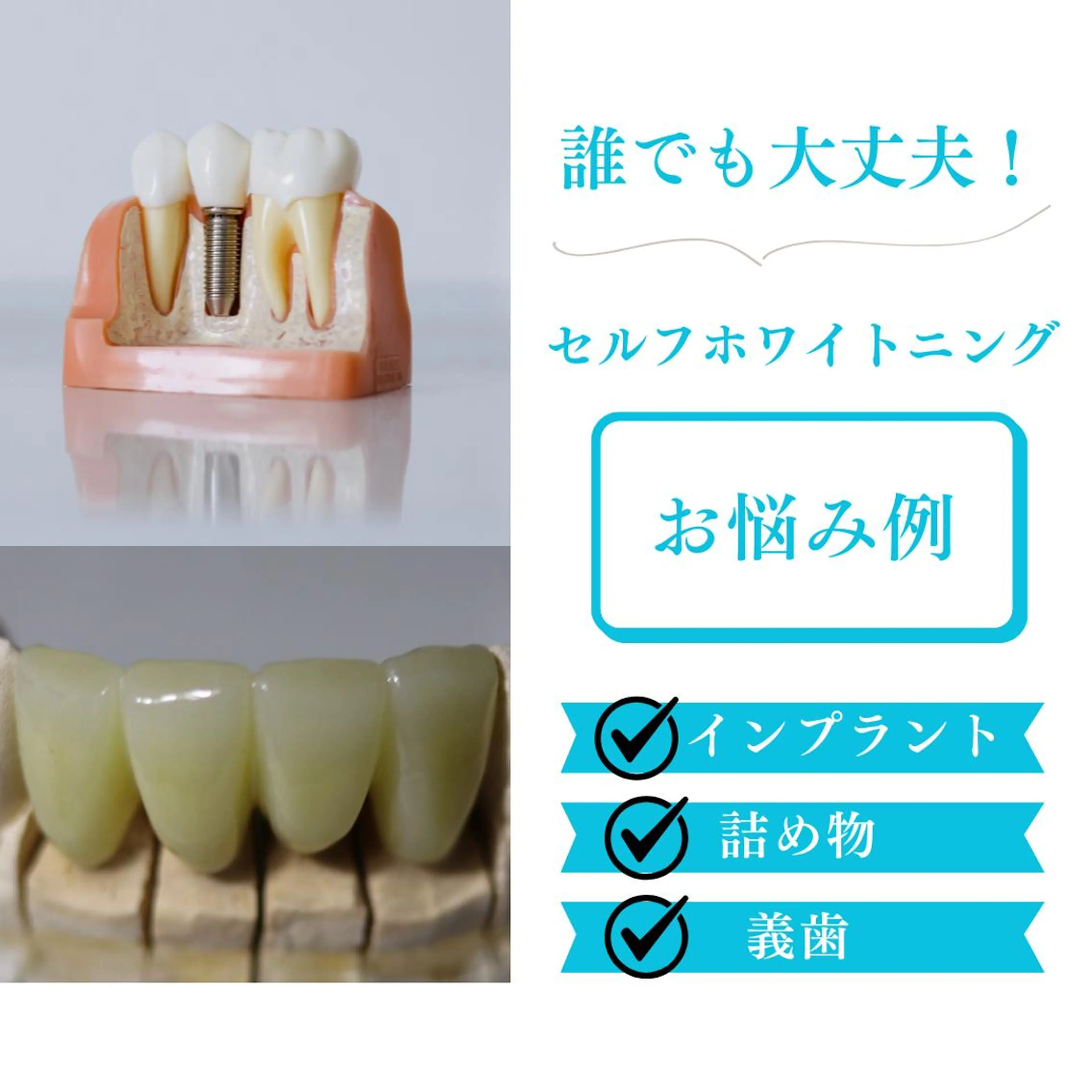 メンズ ショート ホワイトニングサロン nico西葛西店のその他イメージ