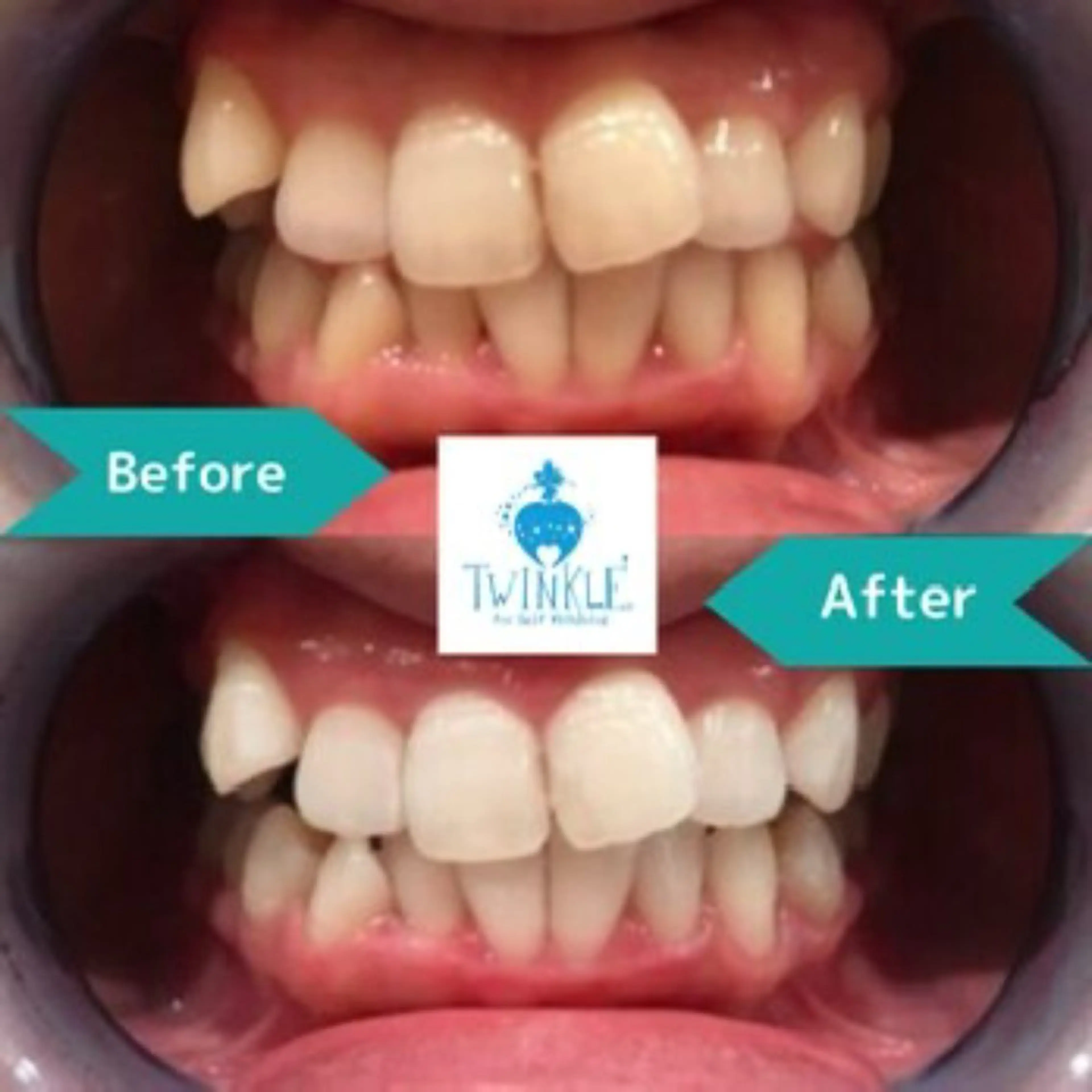 ホワイトニングテラス ティンクルのその他イメージ