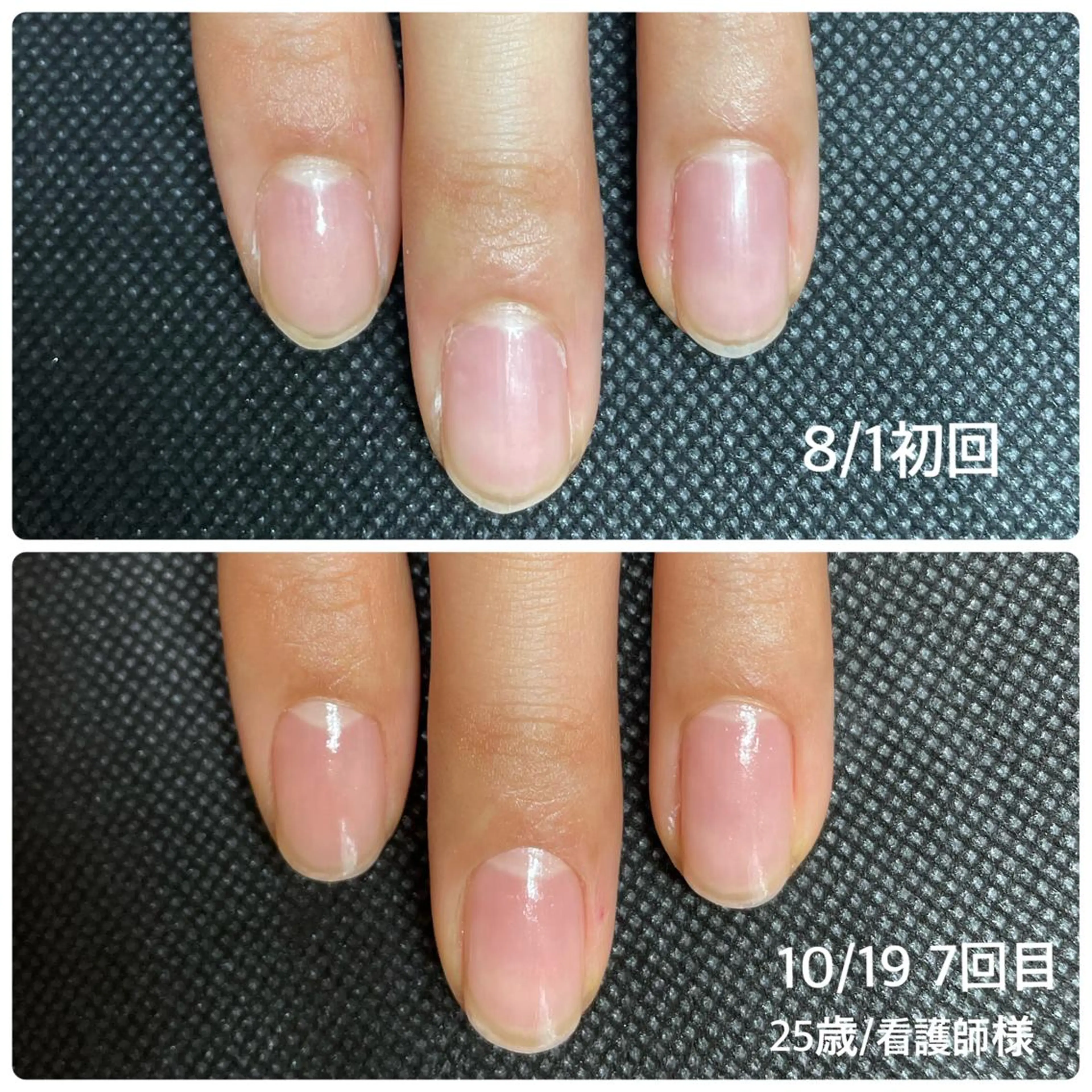 ネイル 奥園 良恵のネイルデザイン