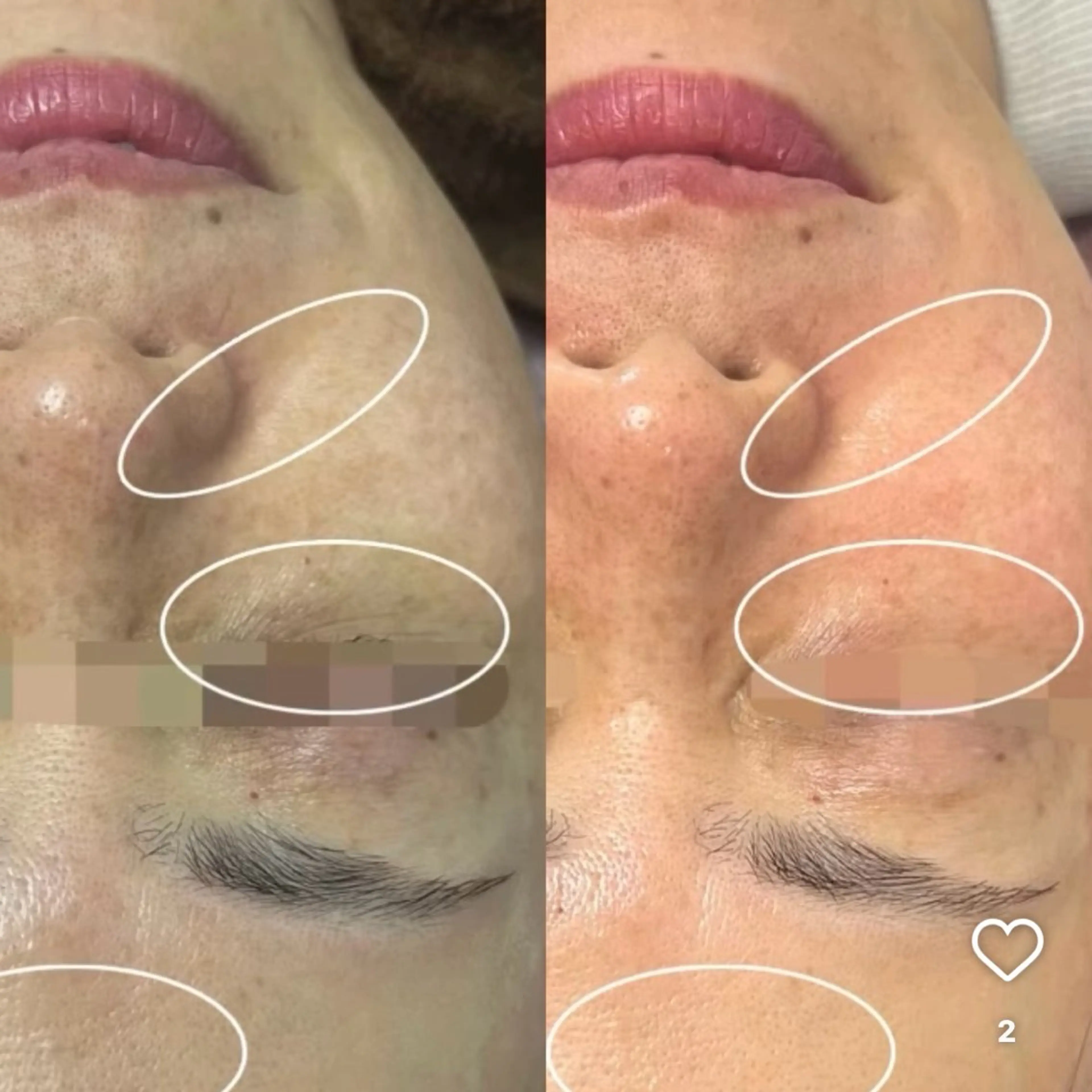 美肌・小顔専門🪄 看護師施術/松﨑のエステ・リラクイメージ