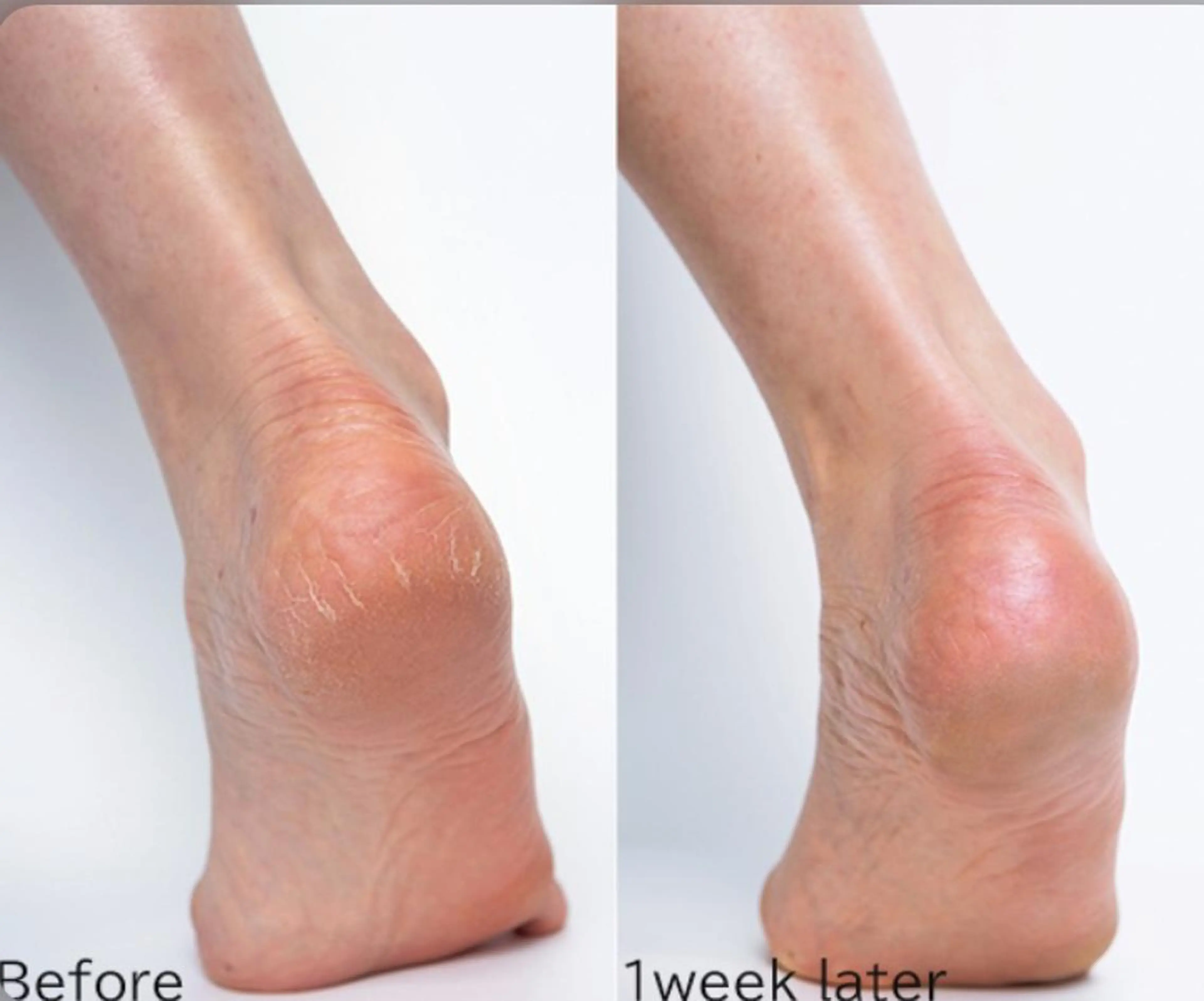 ネイル フットネイル その他(ネイル) 艶々の美爪を〜 【リリアーナ】のネイルデザイン