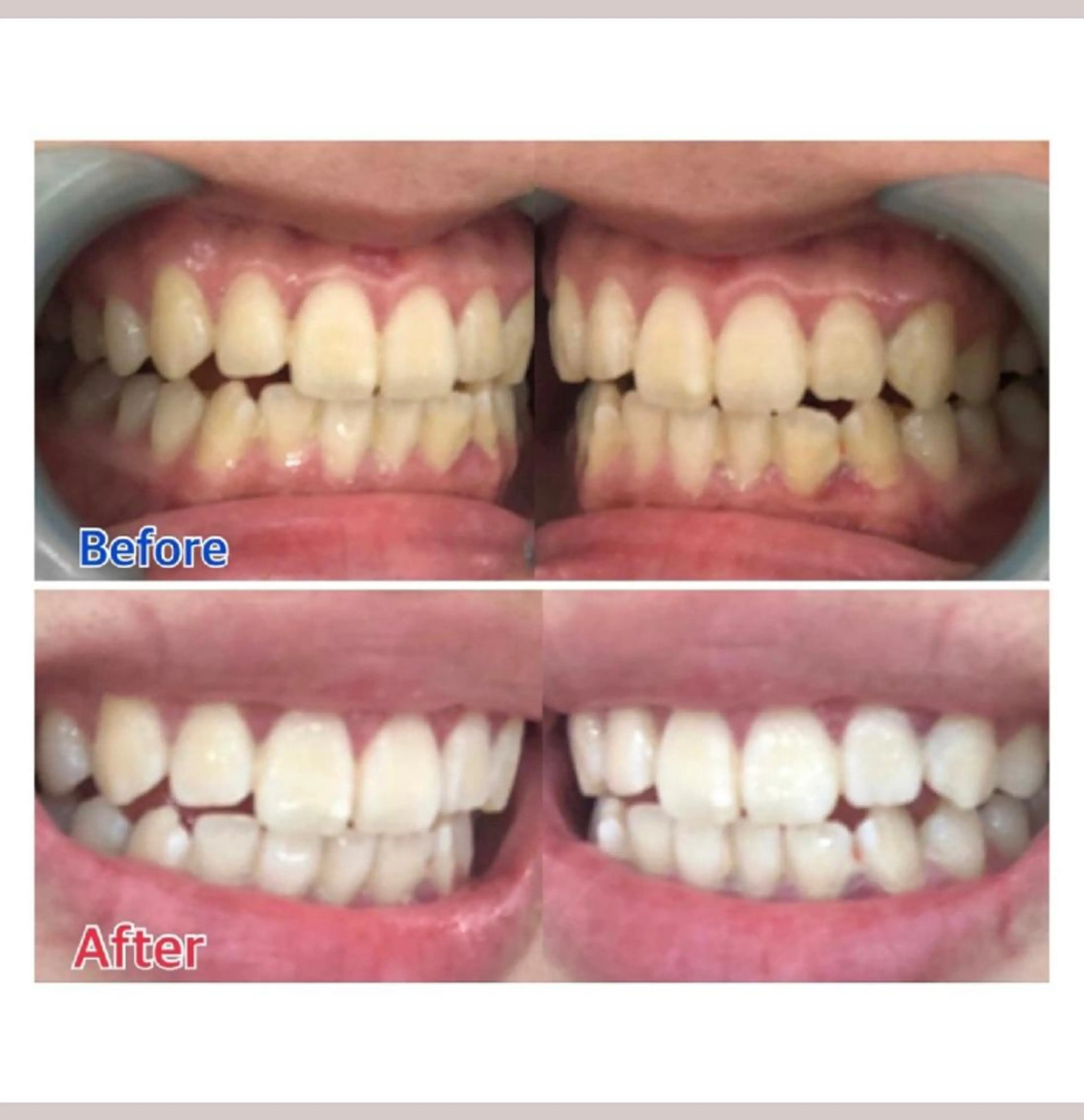 M渋谷 ホワイトニングのエステ・リラクイメージ