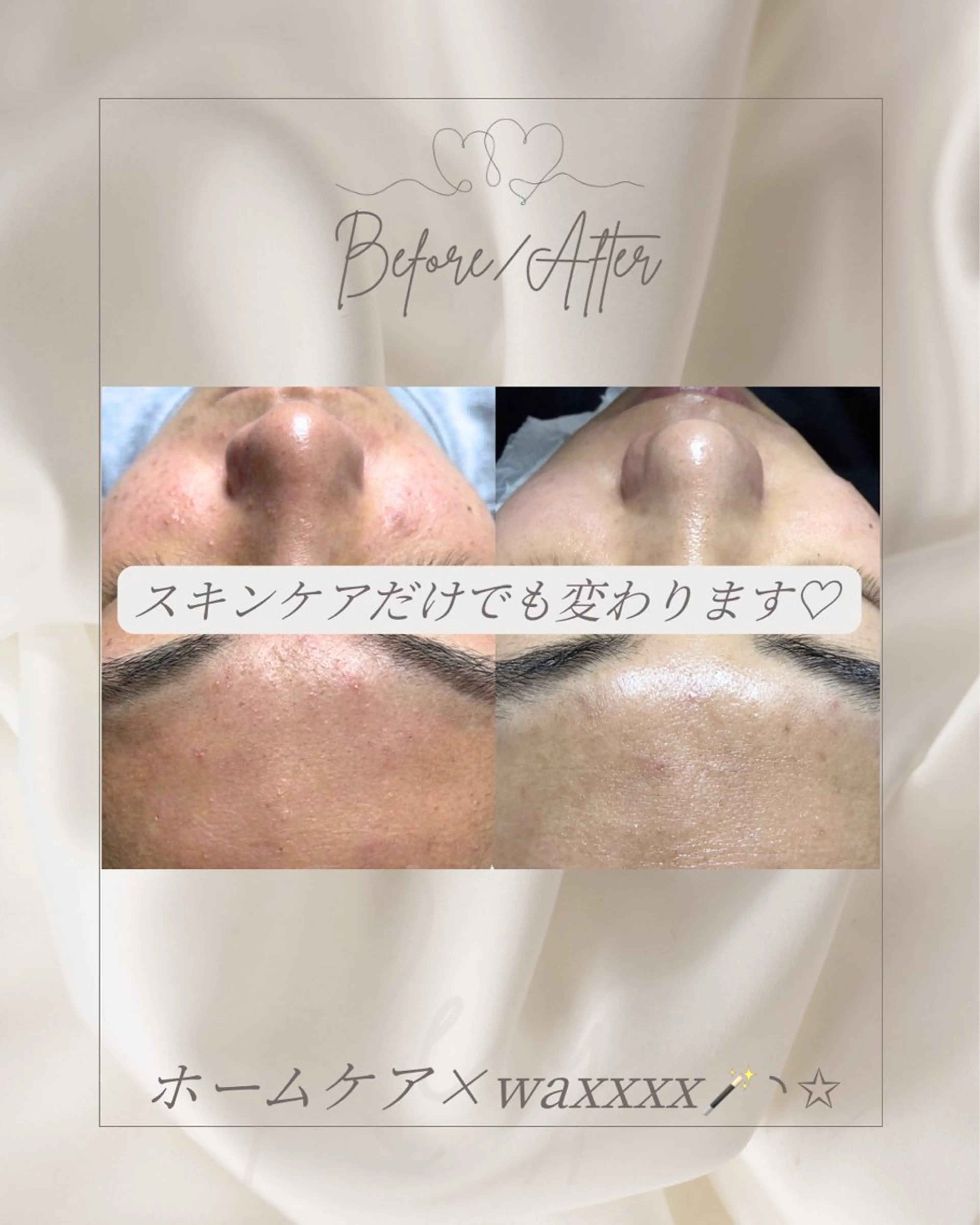 Re:yu 糸島のエステ・リラクイメージ