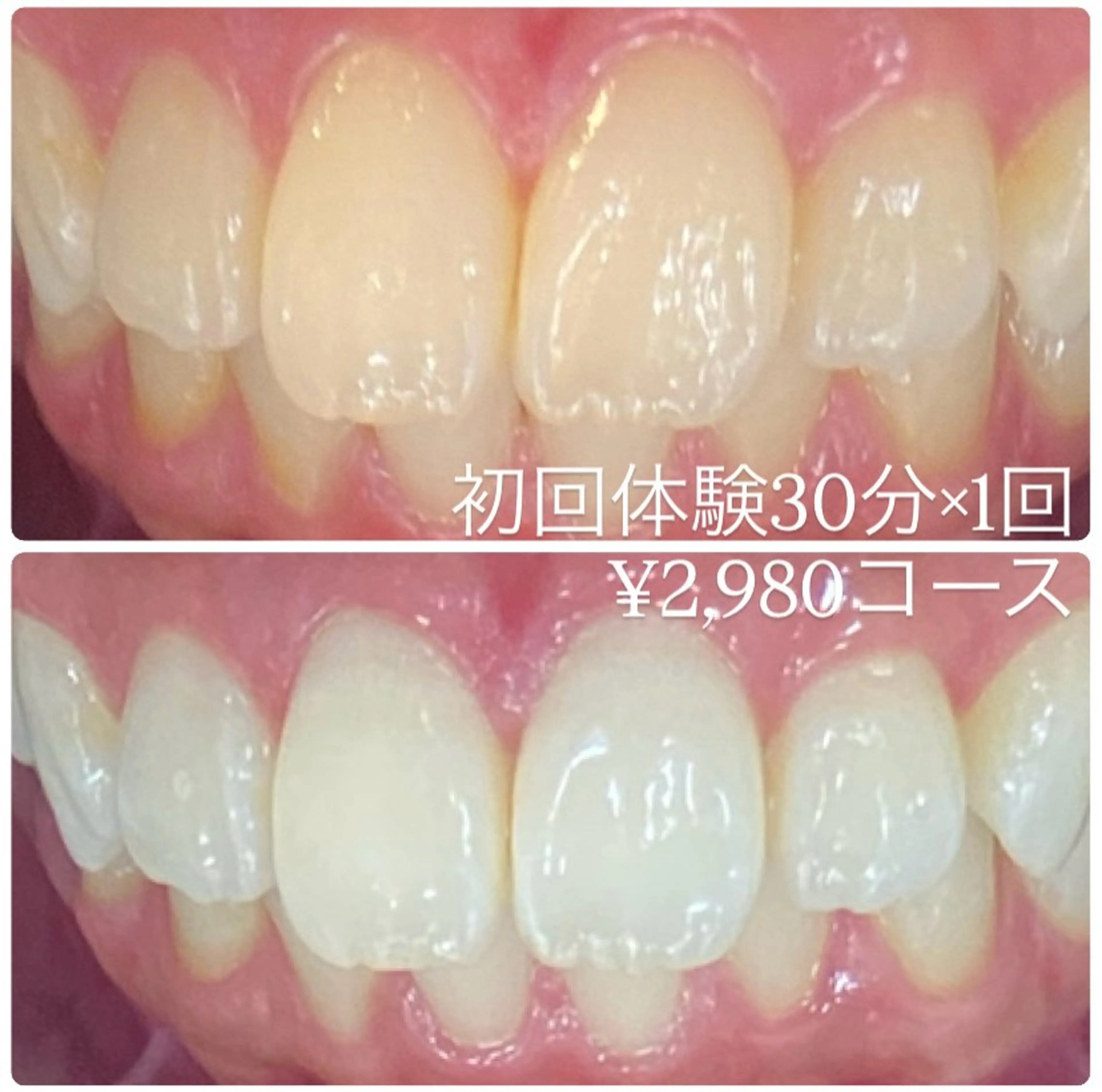 ホワイトニングルーム 横浜店のその他イメージ