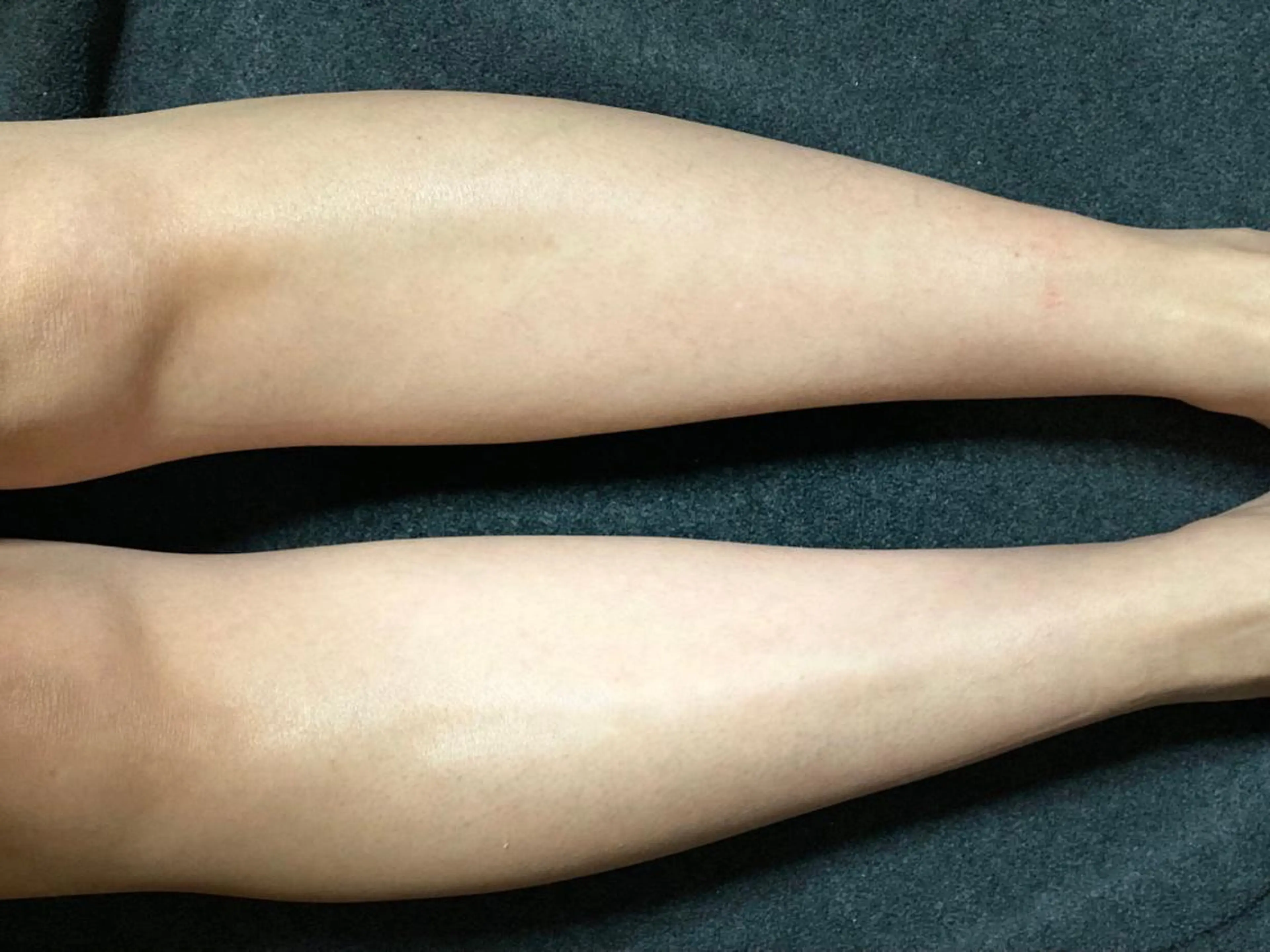 脱毛 R•sugar アールシュガーのエステ・リラクイメージ