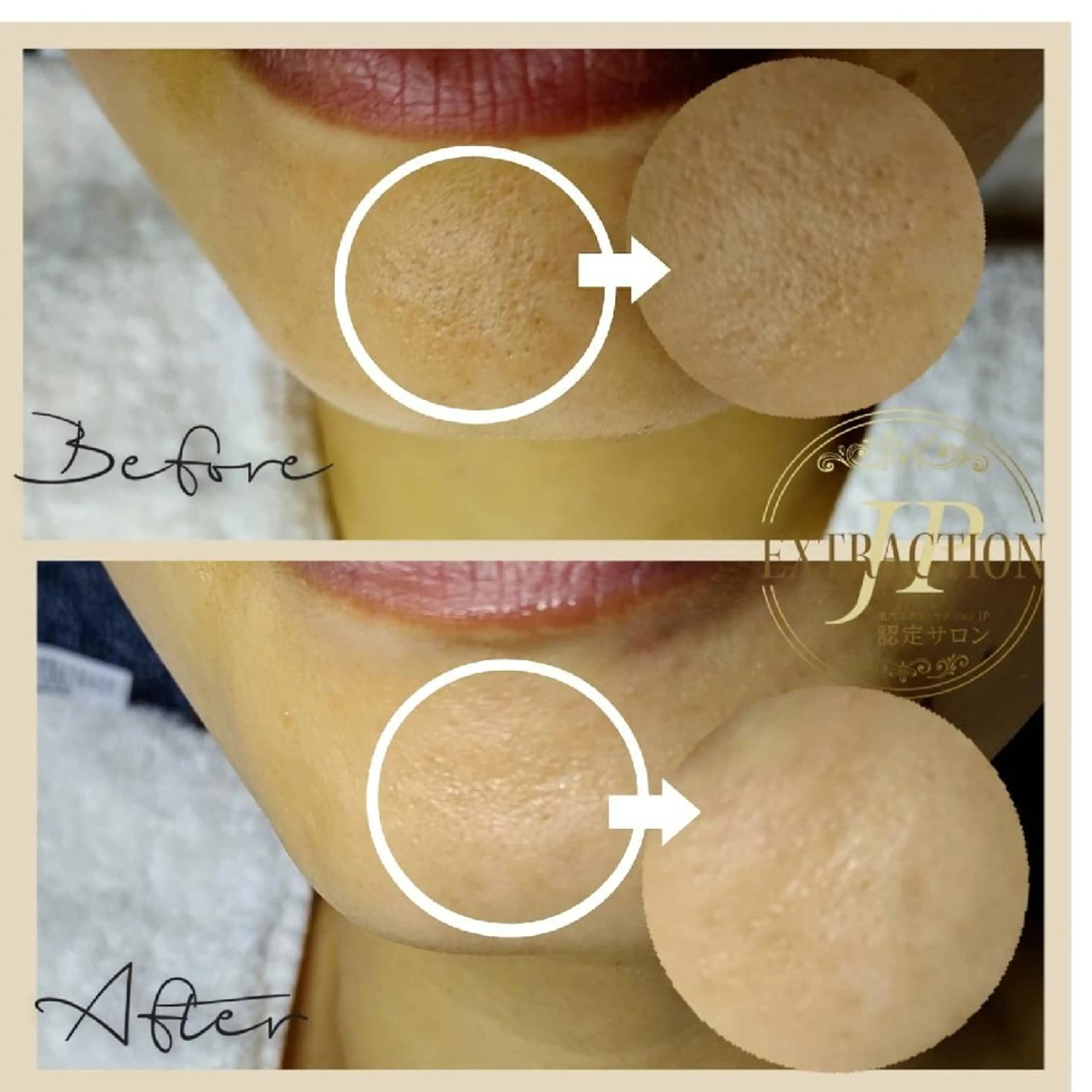 エステ エステサロン Lazulisea所属・川口 春奈のエステ・リラクイメージ