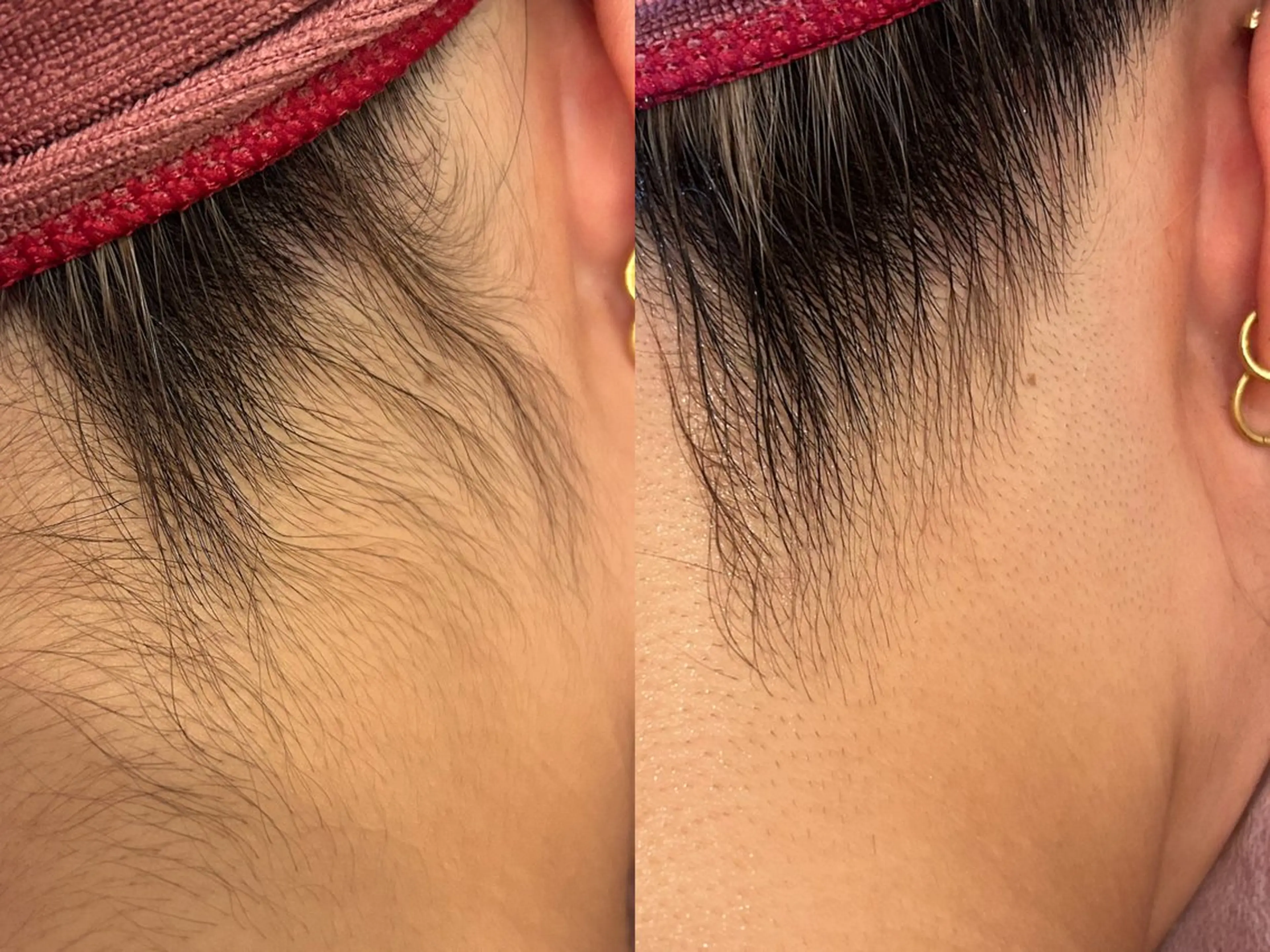 【都度払い脱毛】毛穴 専門サロン  馬車道のエステ・リラクイメージ