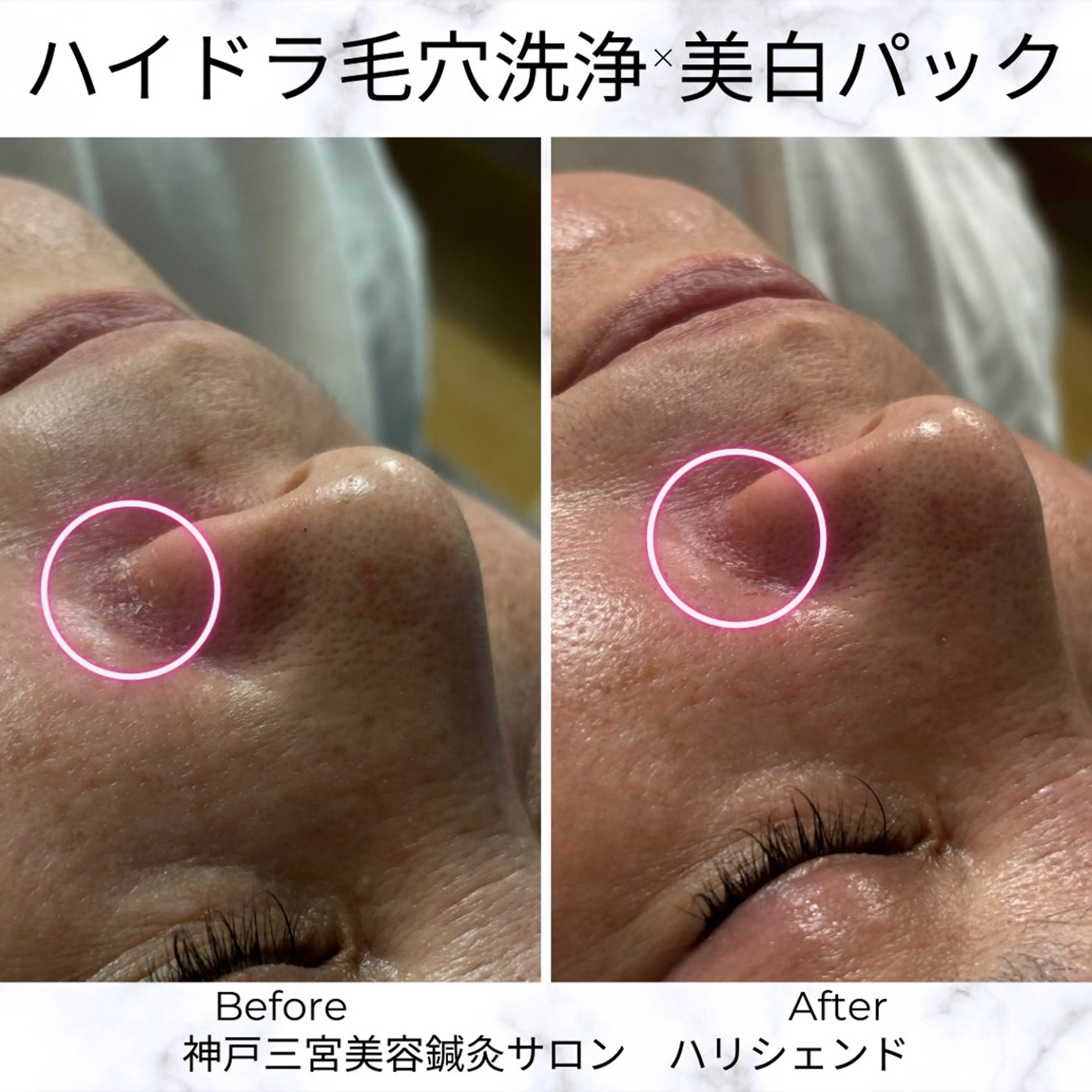 美容鍼・小顔矯正 ハリシェンドのエステ・リラクイメージ