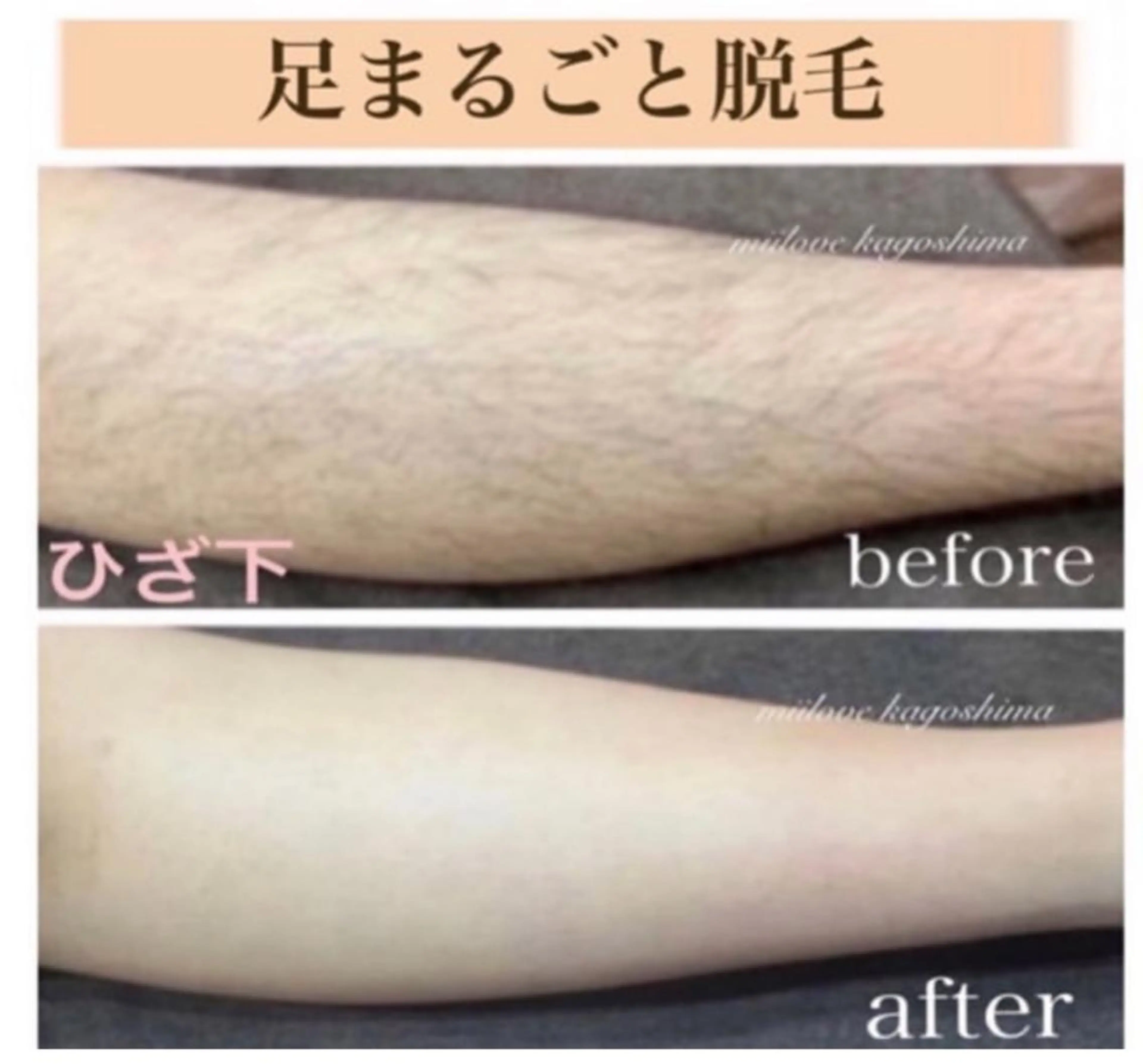 キッズ miilove 鹿児島店のエステ・リラクイメージ