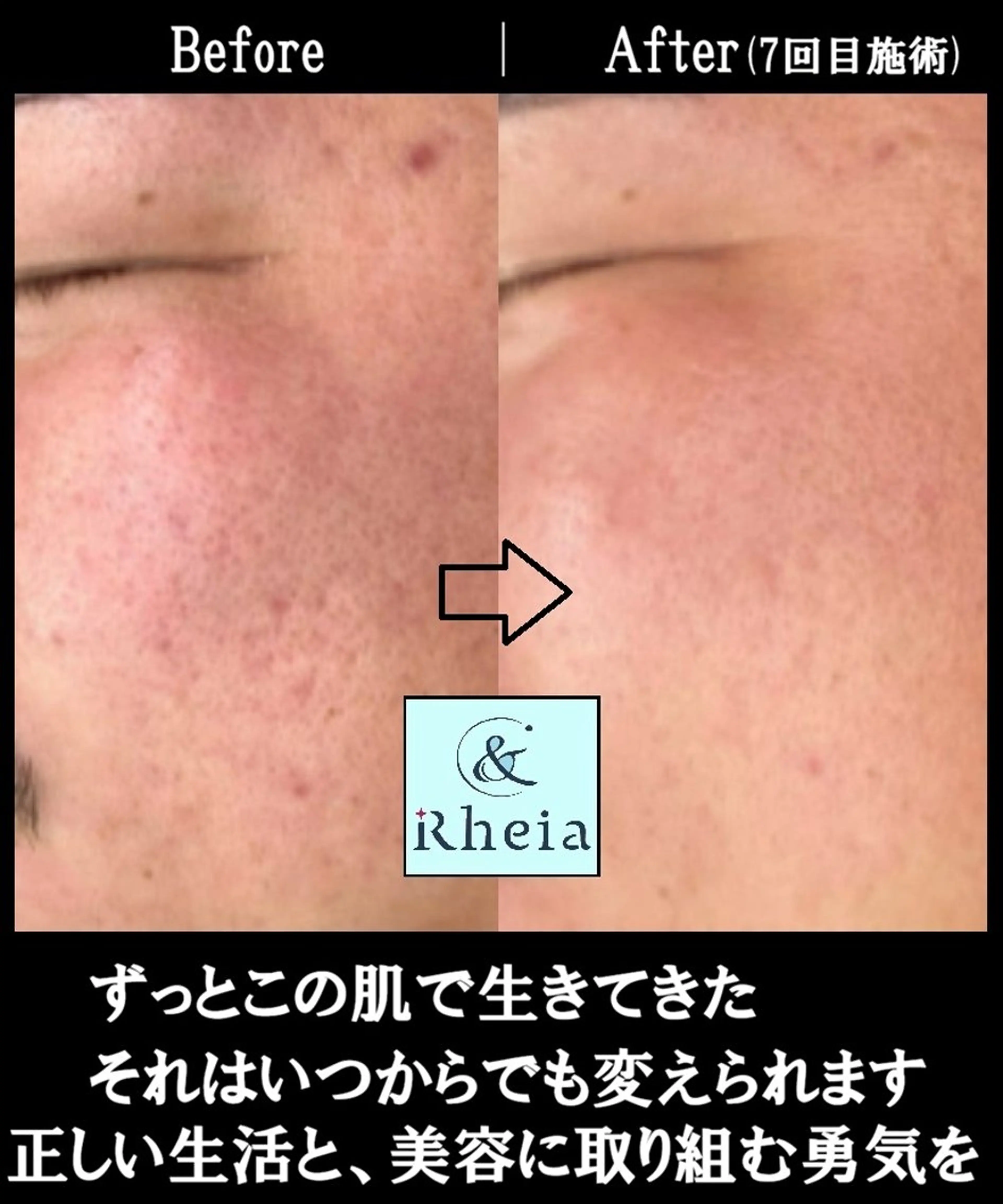 メンズ メンズ眉・肌特化サロン&Rheia(アンドレイア)所属・kawashima mariの眉毛・アイブロウイメージ