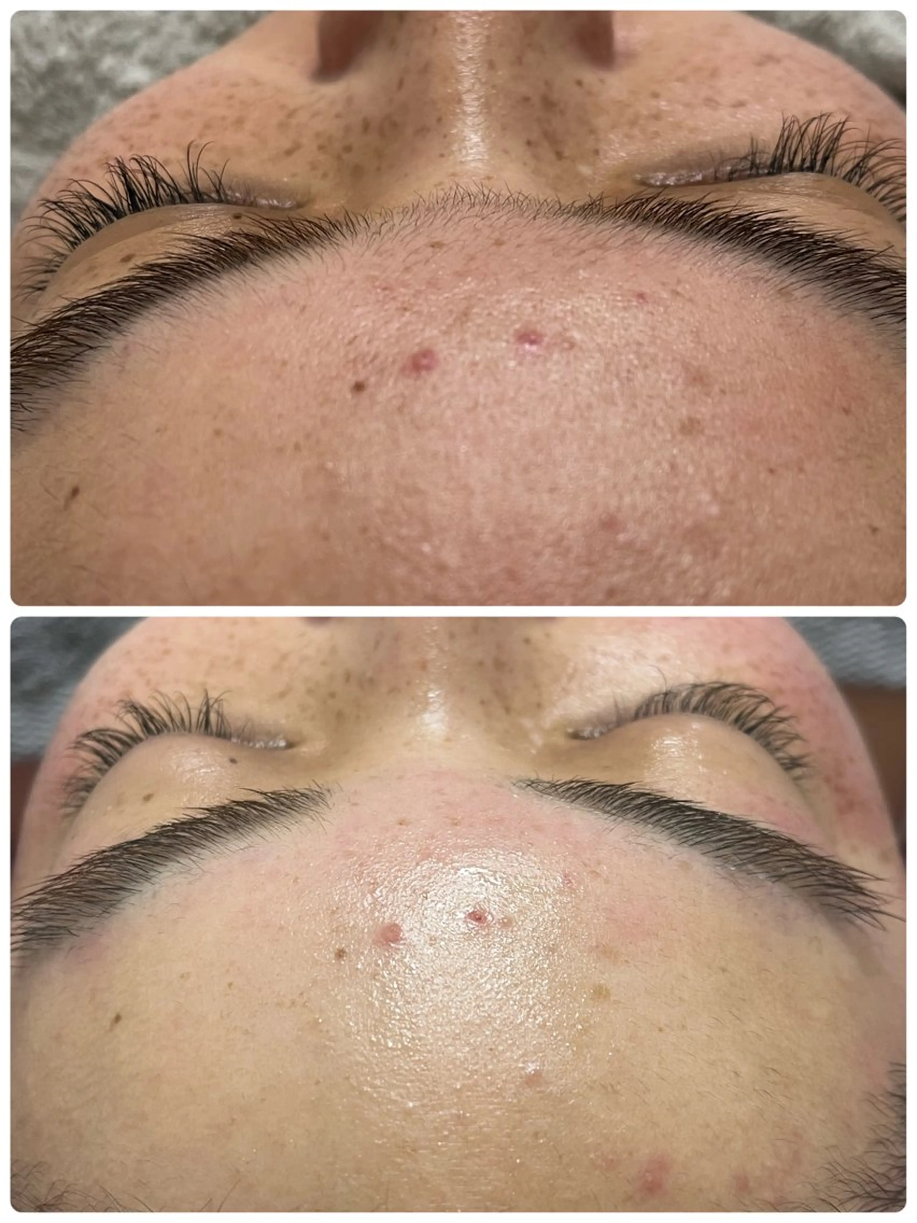 脱毛 MAKANA waxing&relaxation所属・MAKANA 吉岡 小岩店のエステ・リラクイメージ