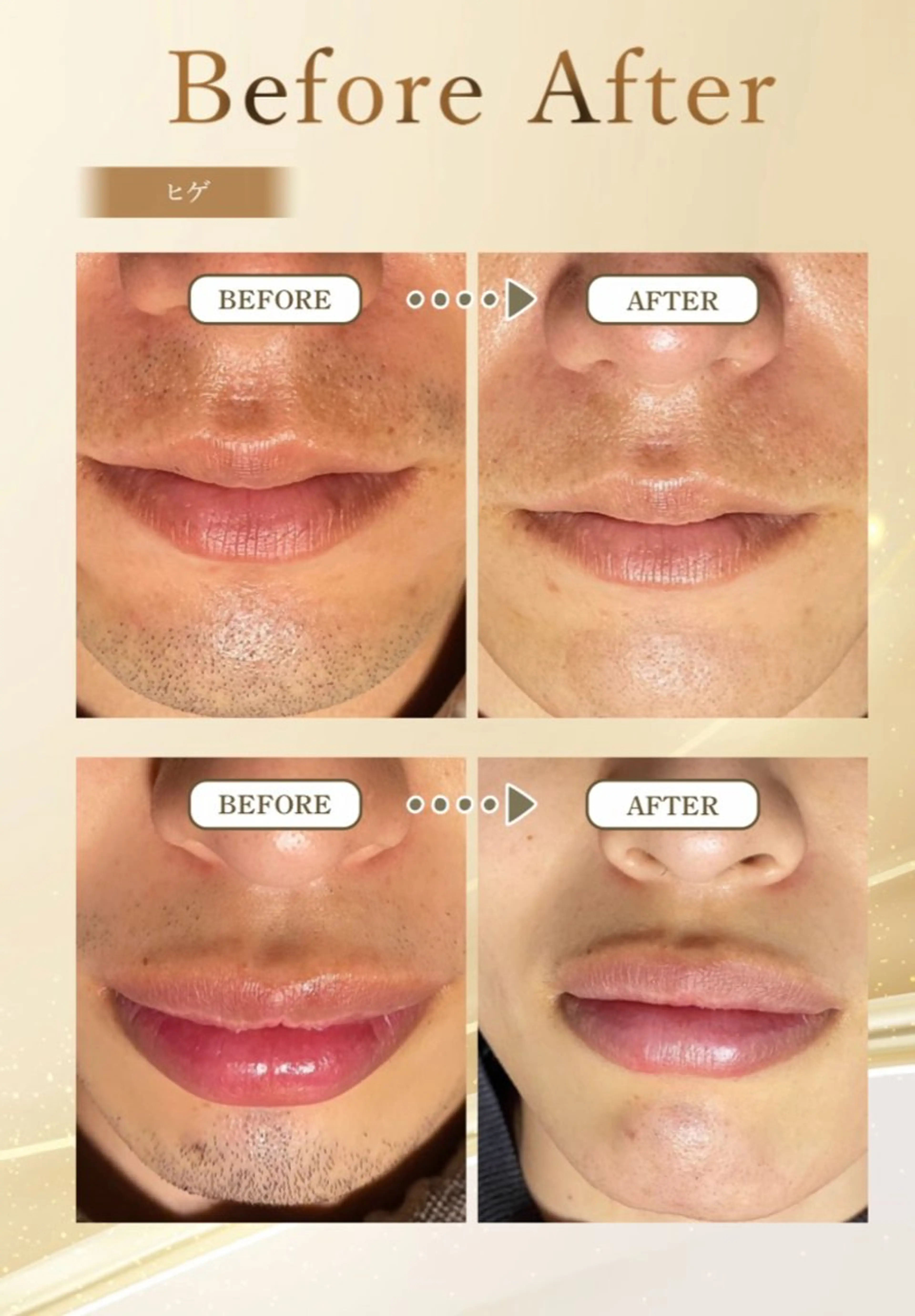 メンズ 西岡 /マツエク/束感🎀のマツエク・マツパデザイン