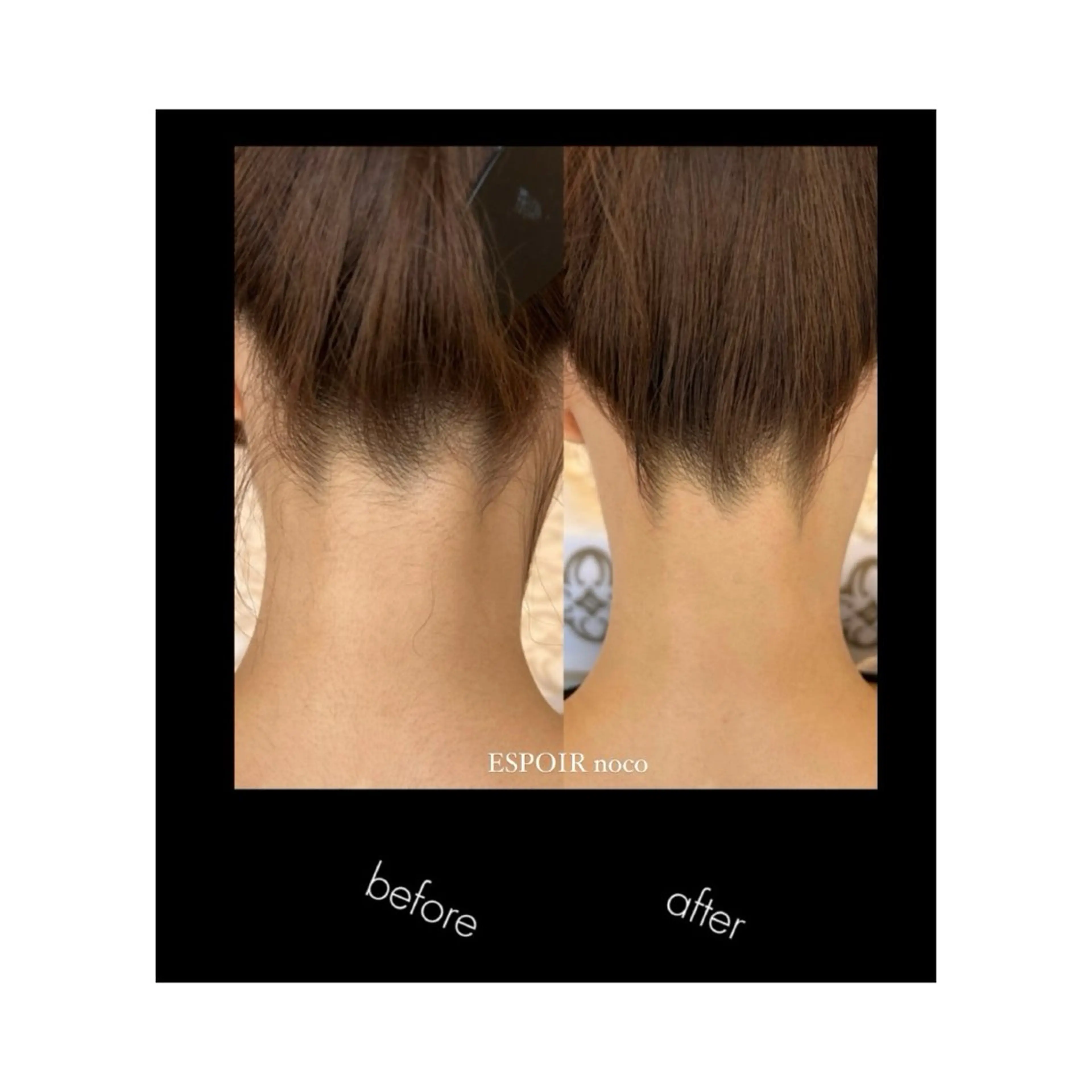 ワックス脱毛🌈 ESPOIRnocoのエステ・リラクイメージ