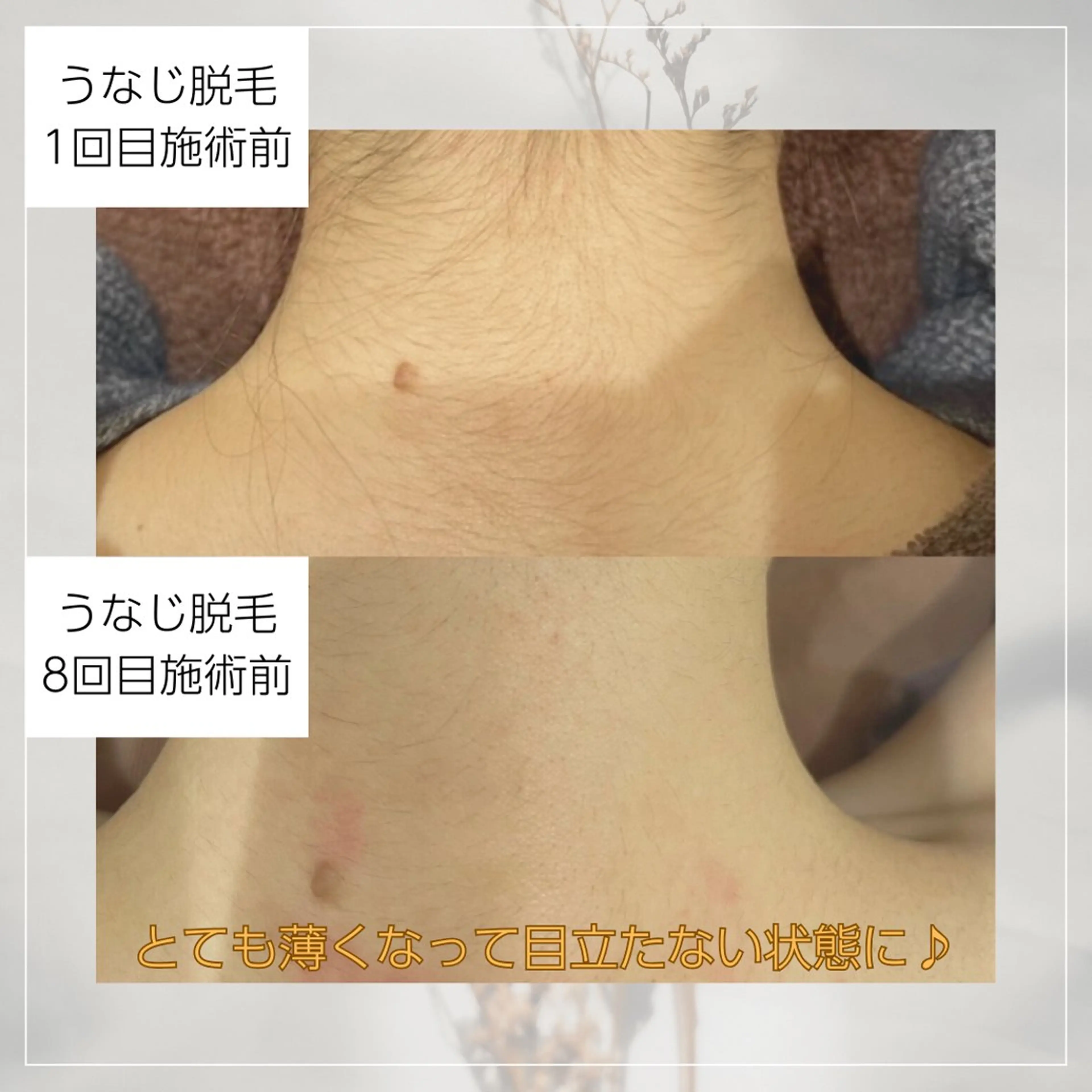 vary  clue MISAのその他イメージ