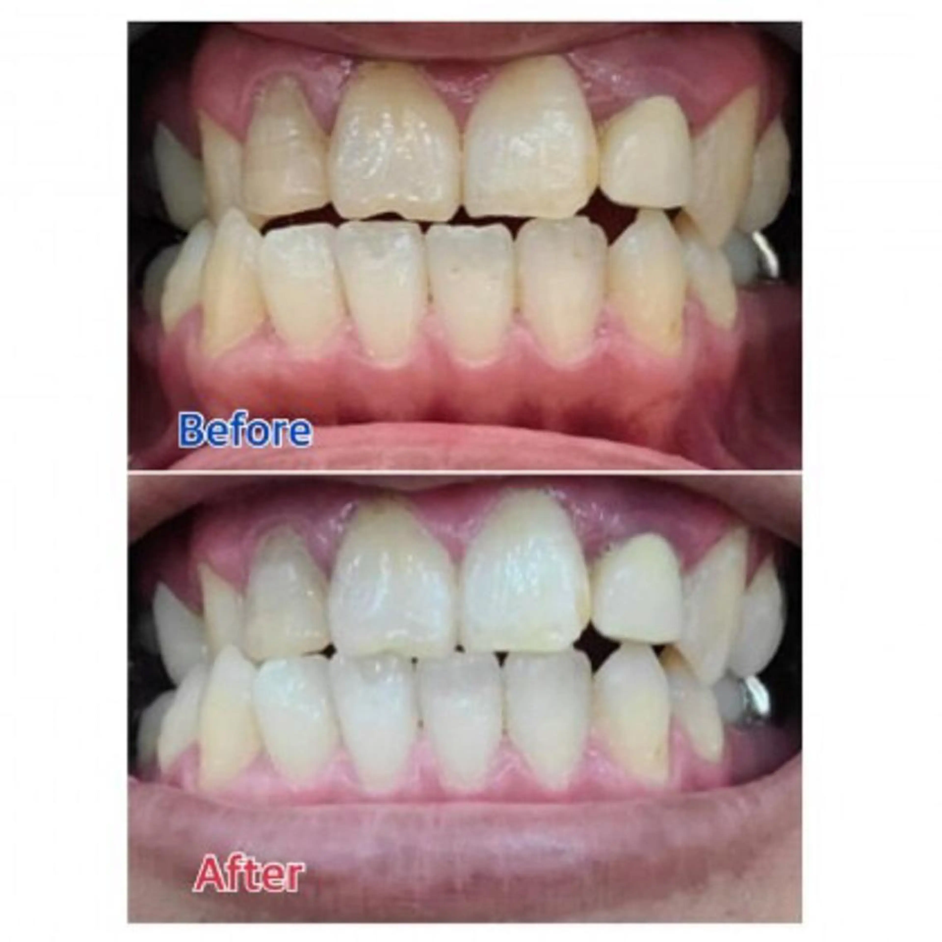 Ｍ渋谷 ホワイトニングのエステ・リラクイメージ