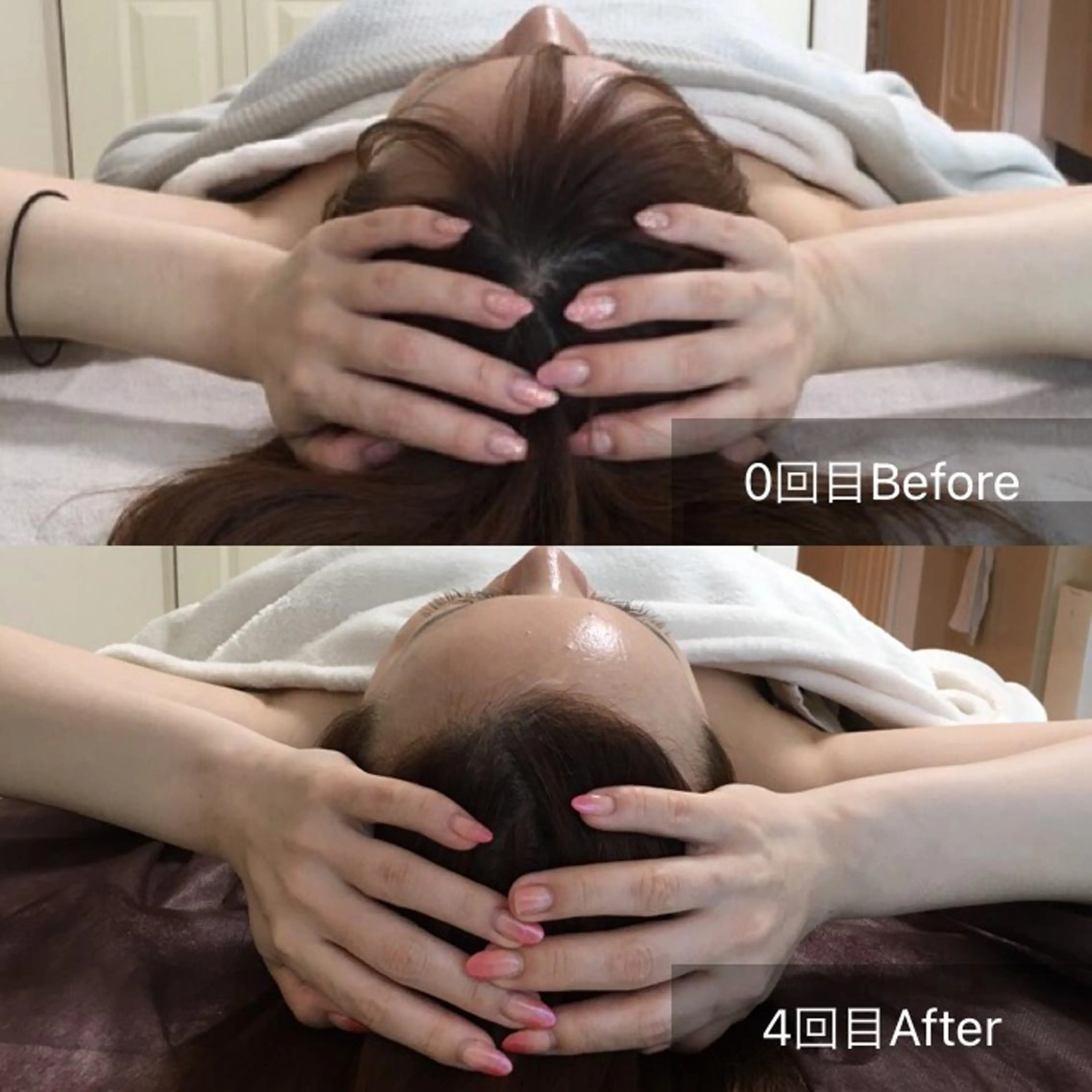 人気No.1脳洗浄®︎短期集中4回コース+メンテナンス1回毎月2名様限定の写真