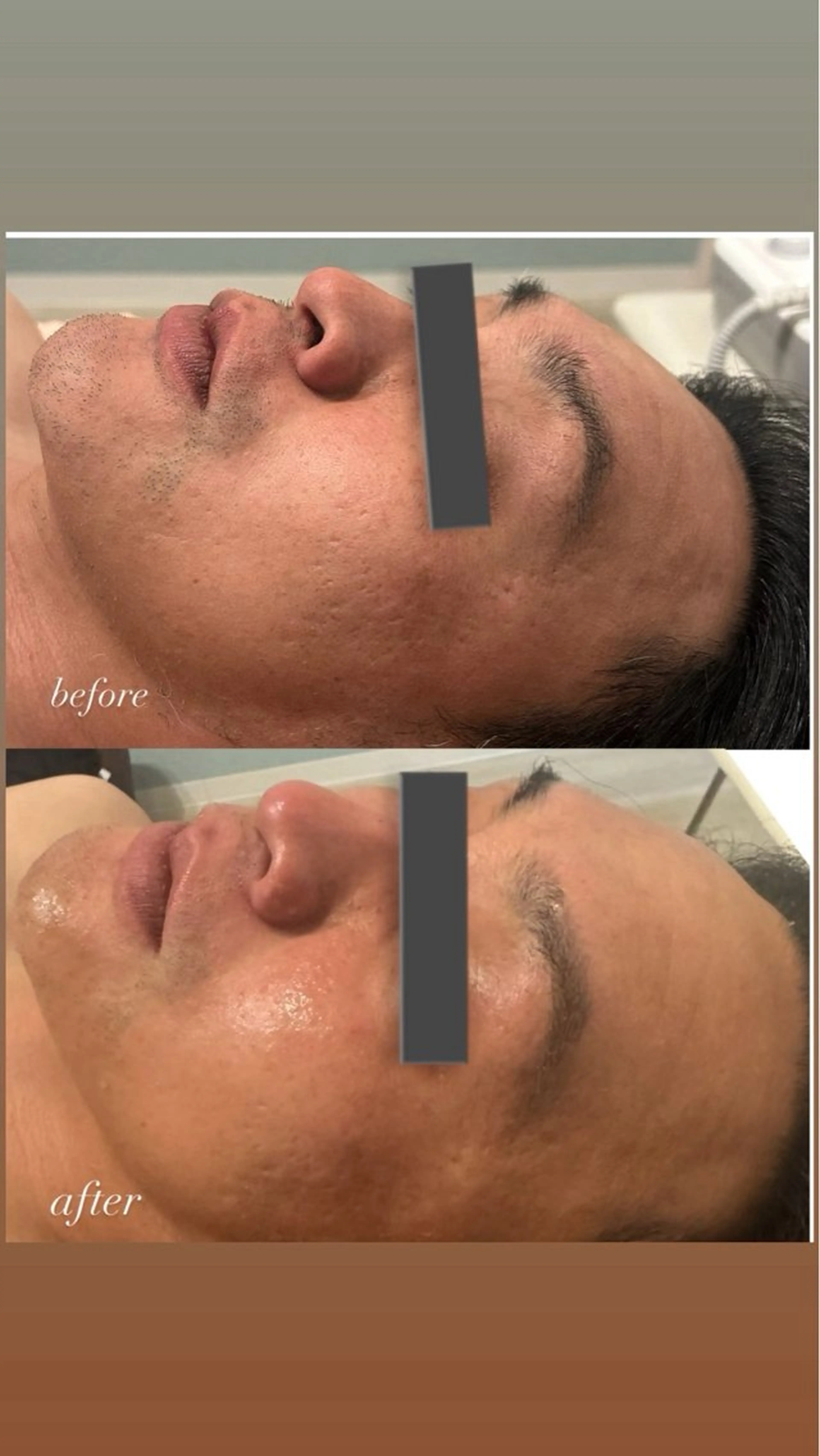 メンズ 梅野 さくらのエステ・リラクイメージ