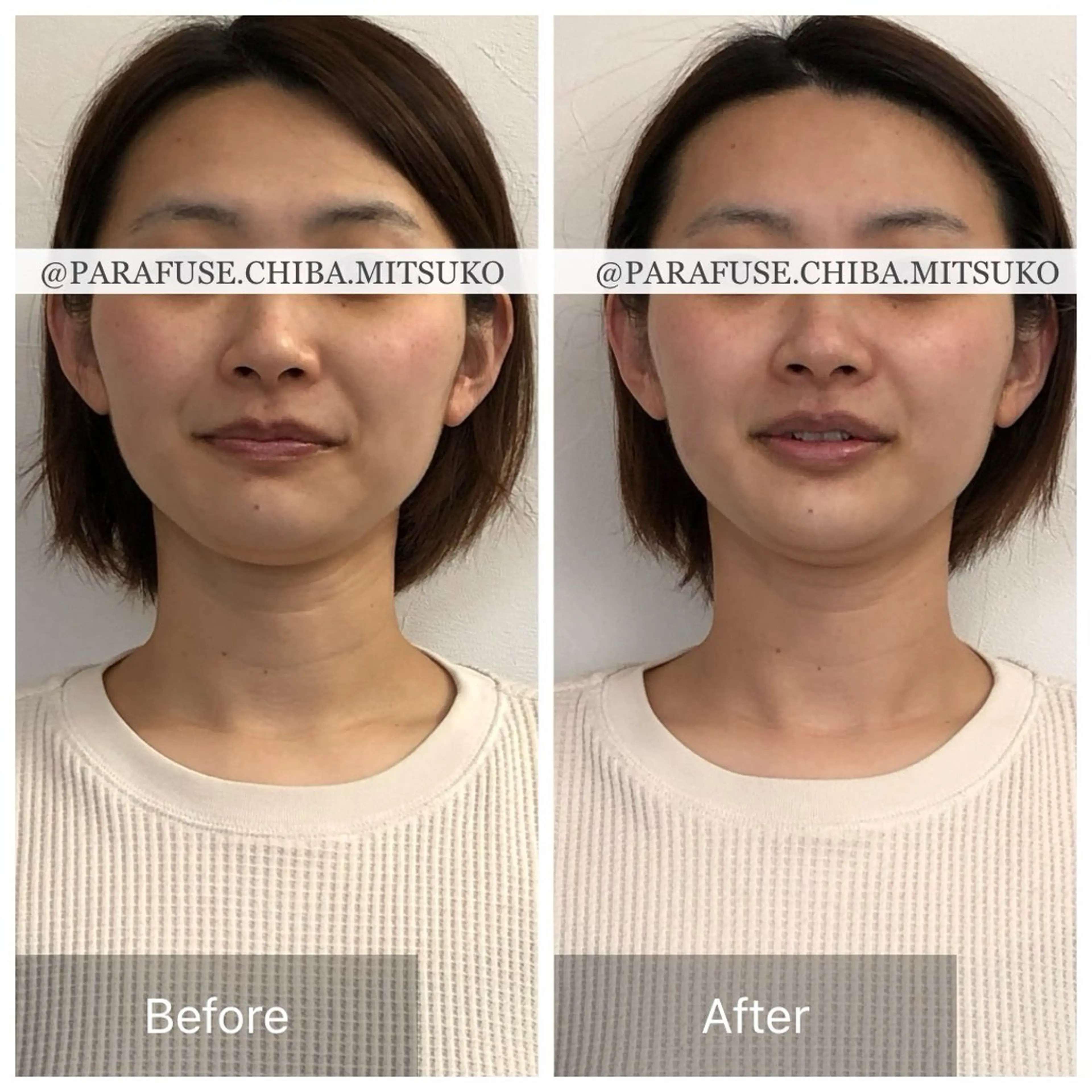 脳洗浄✳︎マツヤニ/ みつこのエステ・リラクイメージ