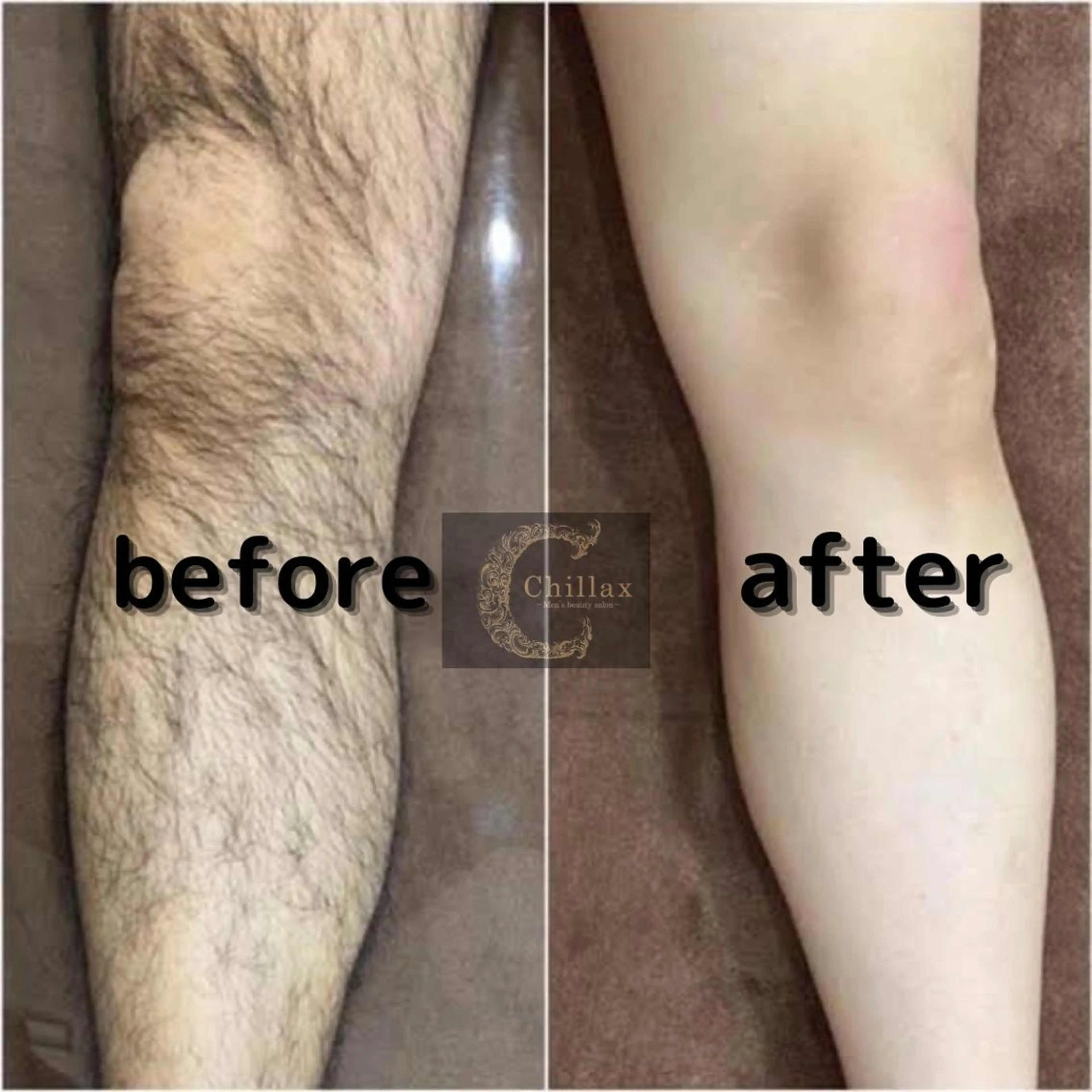 メンズ メンズ脱毛サロン Chillax中野店のエステ・リラクイメージ