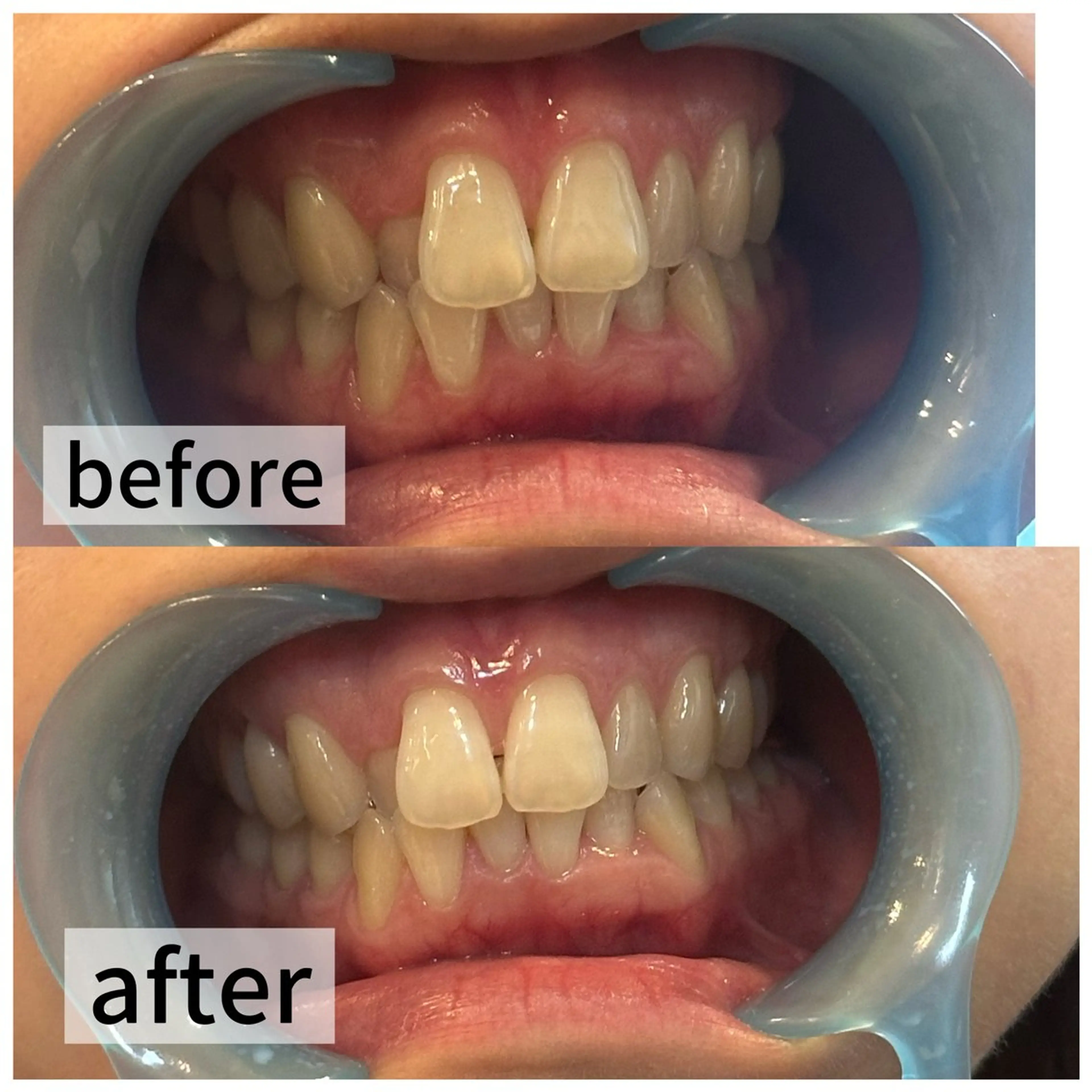 その他 浮腫|肩こり|張り 日々の疲れを解消★のエステ・リラクイメージ