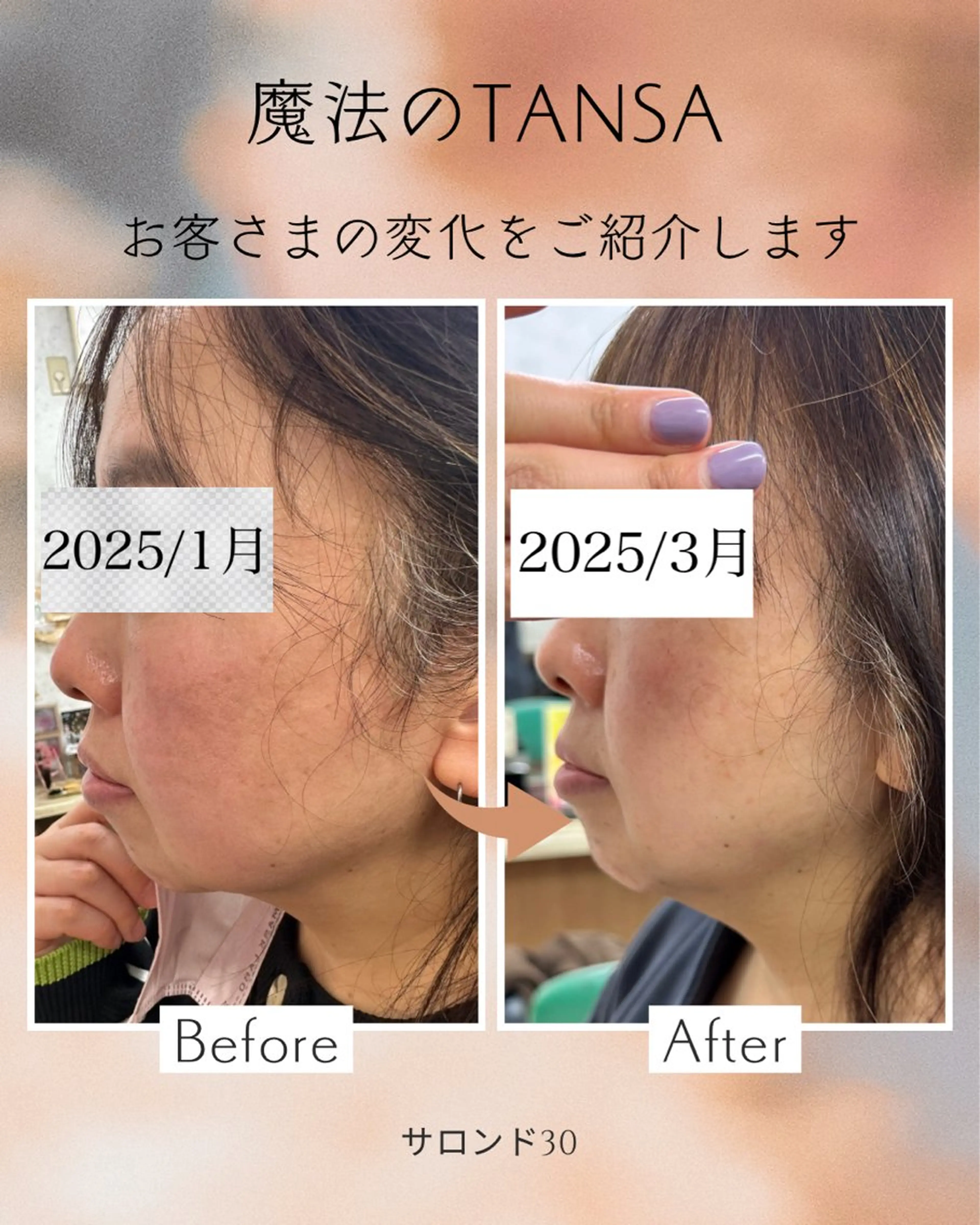 髪質改善のプロ✨りな さんのその他イメージ