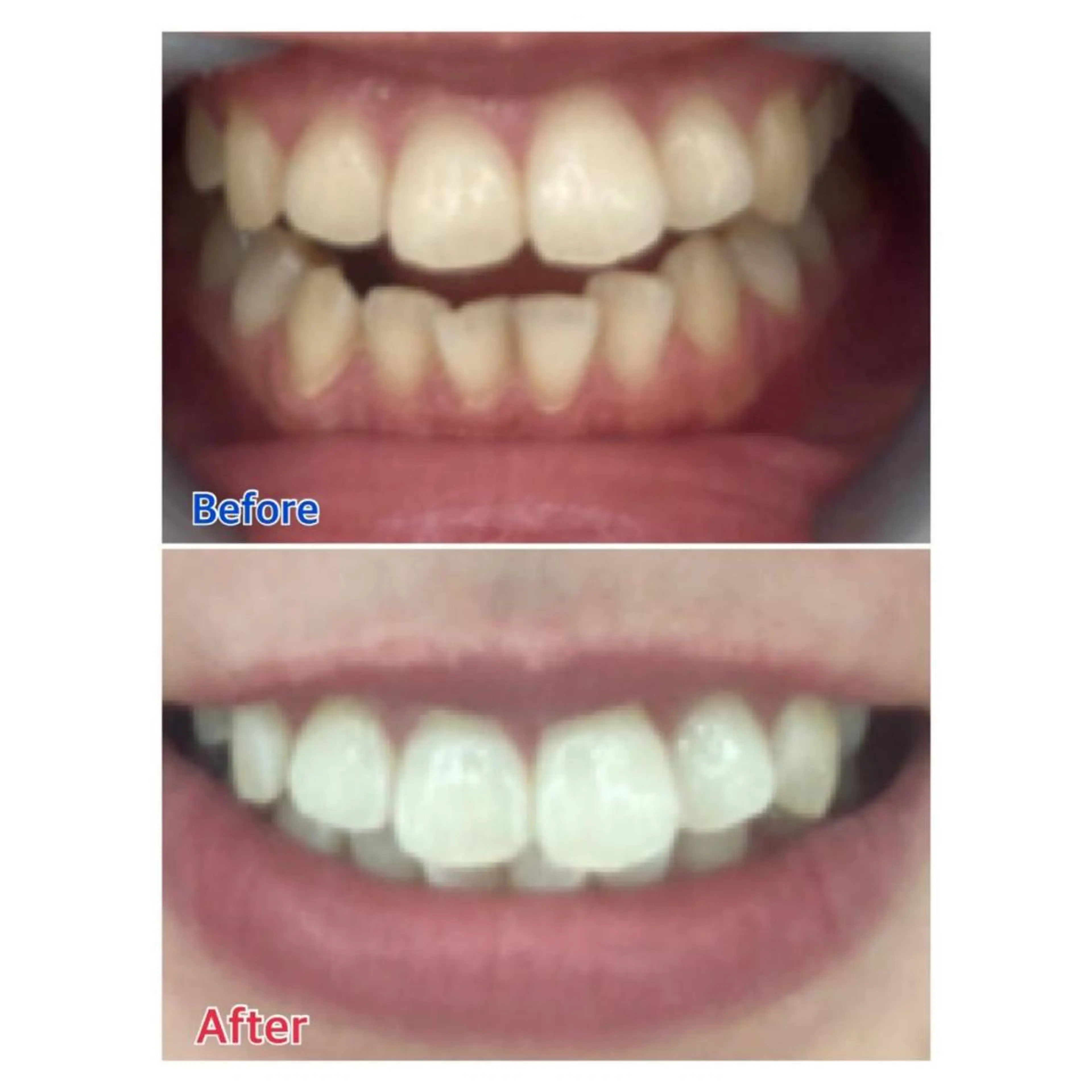 MBEAUTYSALON 千葉店・京成大久保所属・Melty 輝のその他イメージ