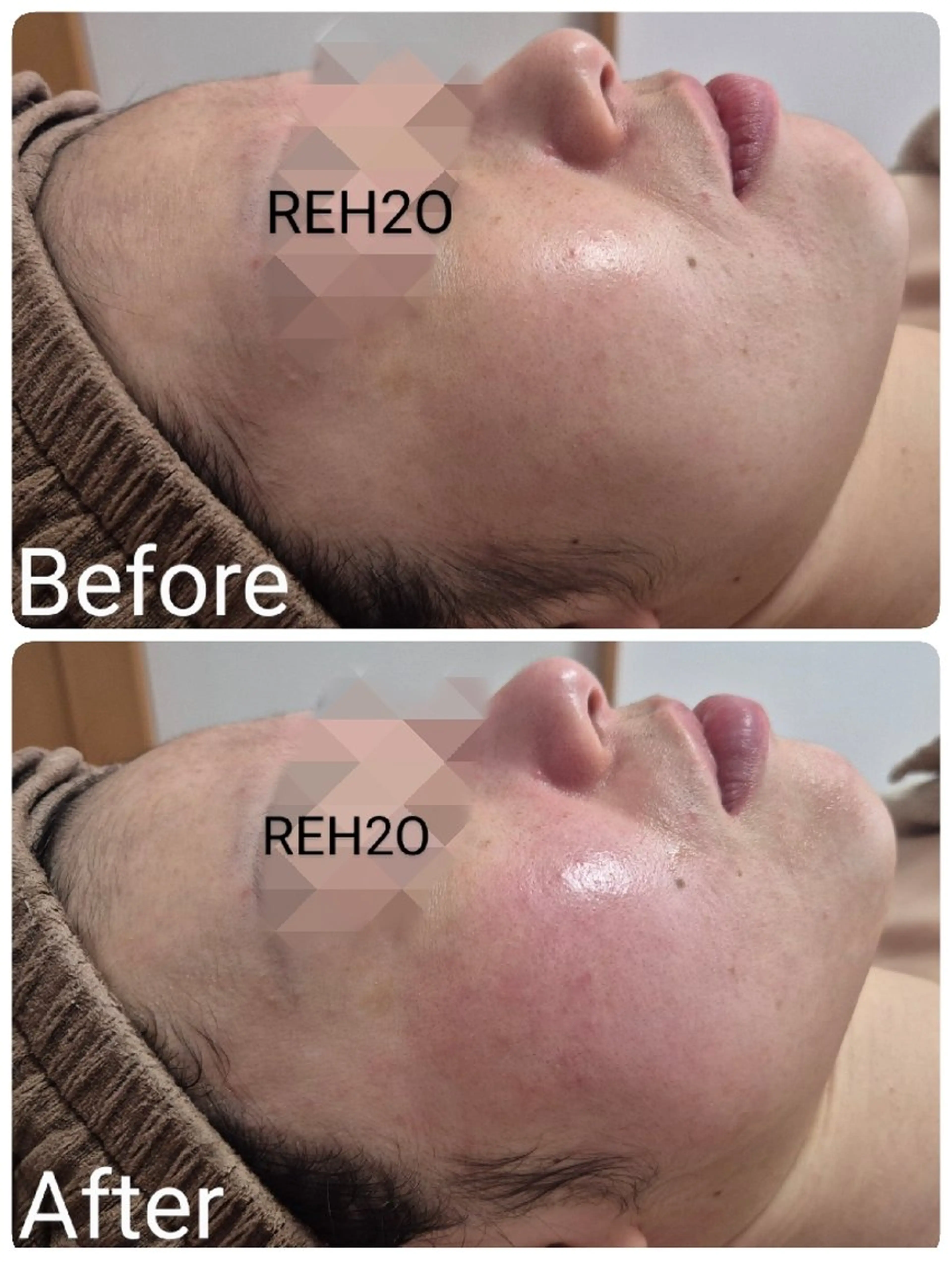 エステ REH2O Rihoのエステ・リラクイメージ