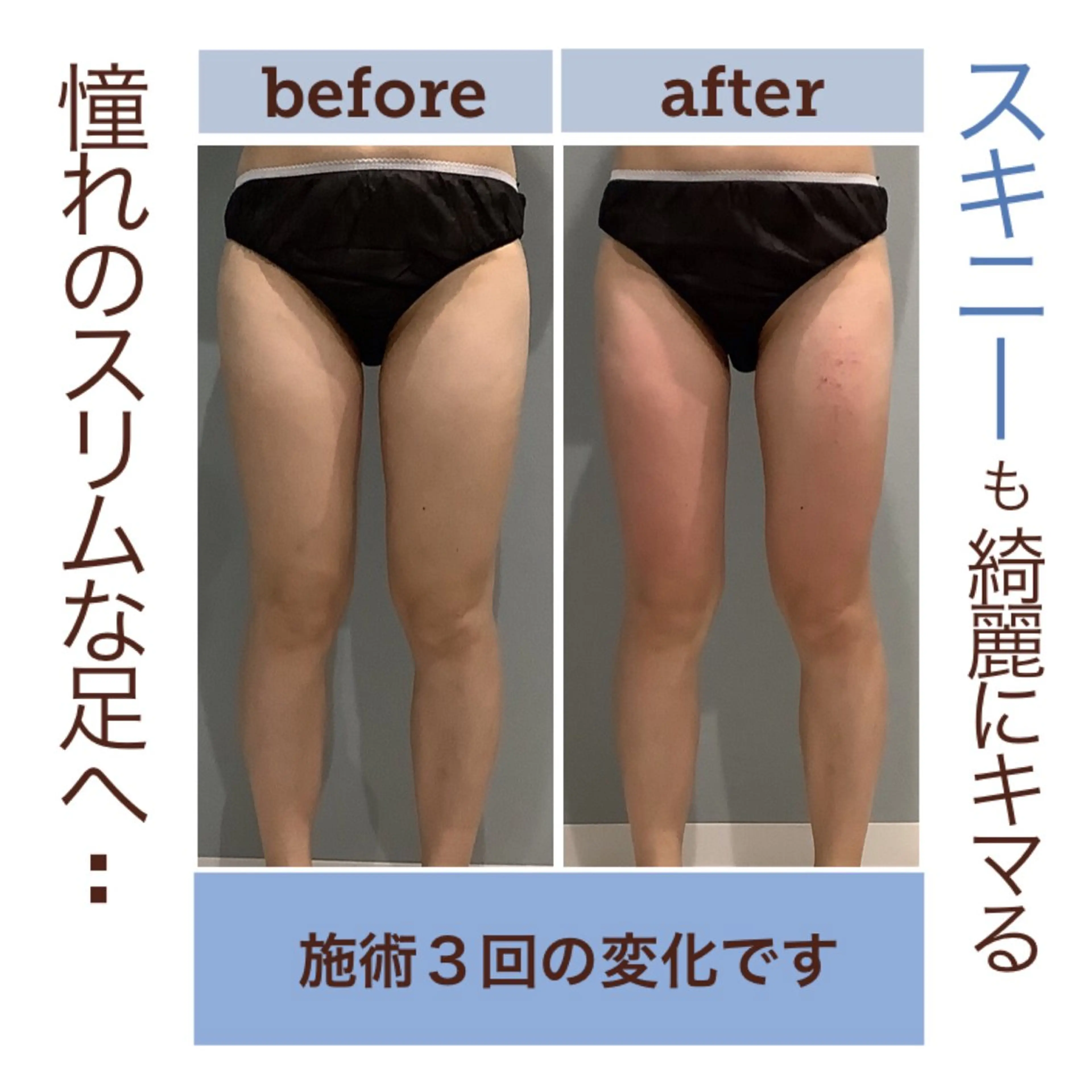 エステ エステサロン JURISのエステ・リラクイメージ