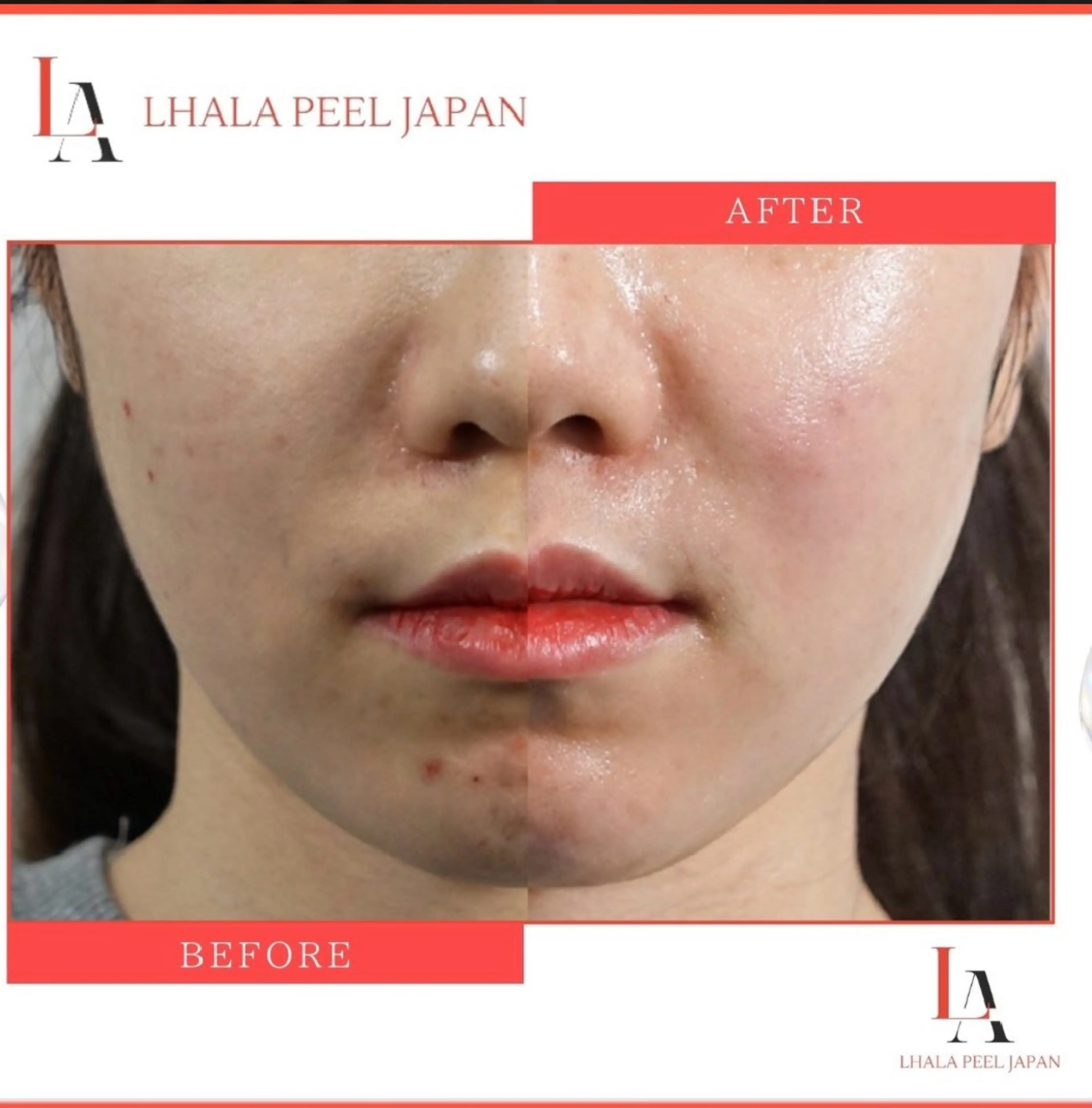 エステ リラク 目元・まつパ・美肌フ ェイシャル谷町四丁目のマツエク・マツパデザイン