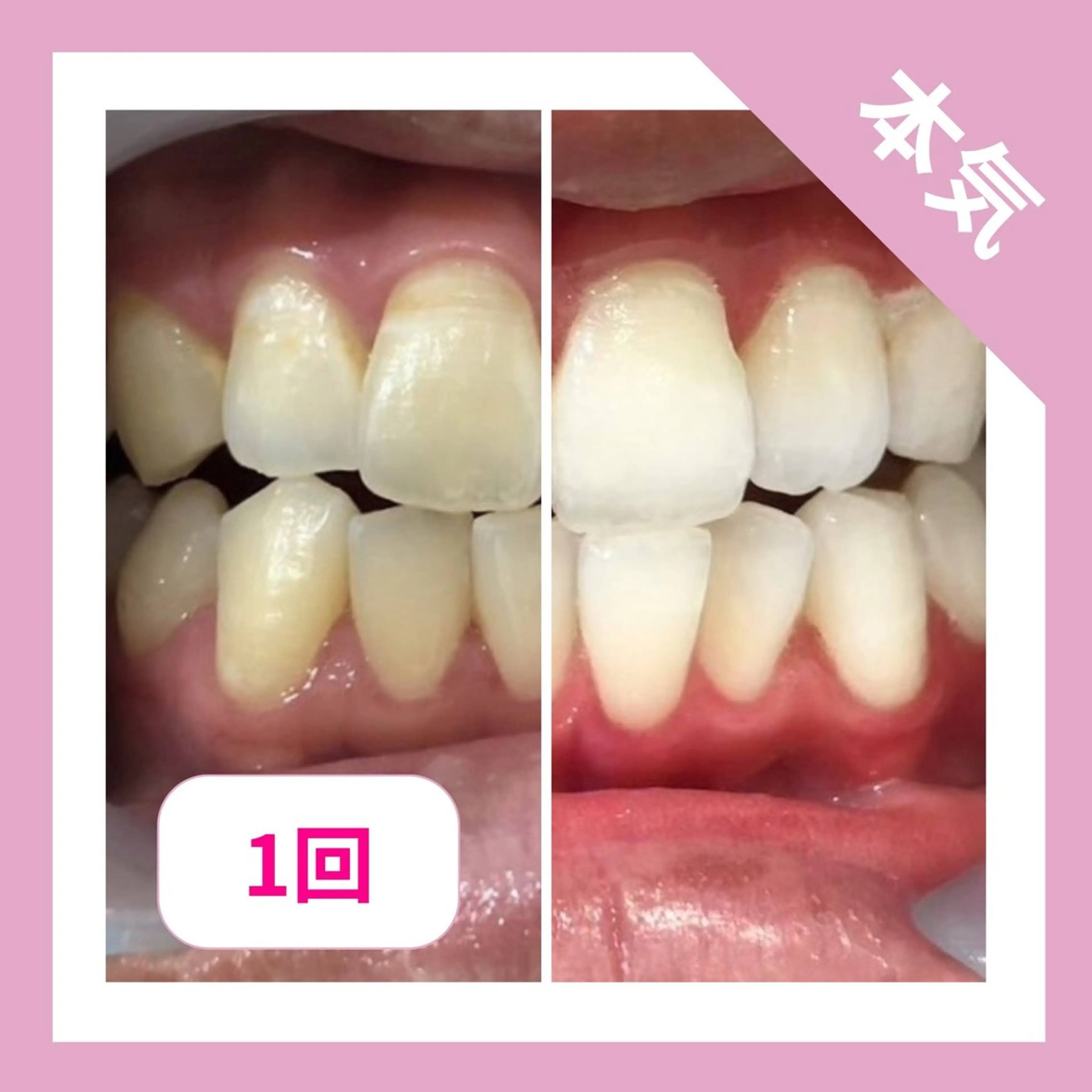 藤井 ののみのエステ・リラクイメージ