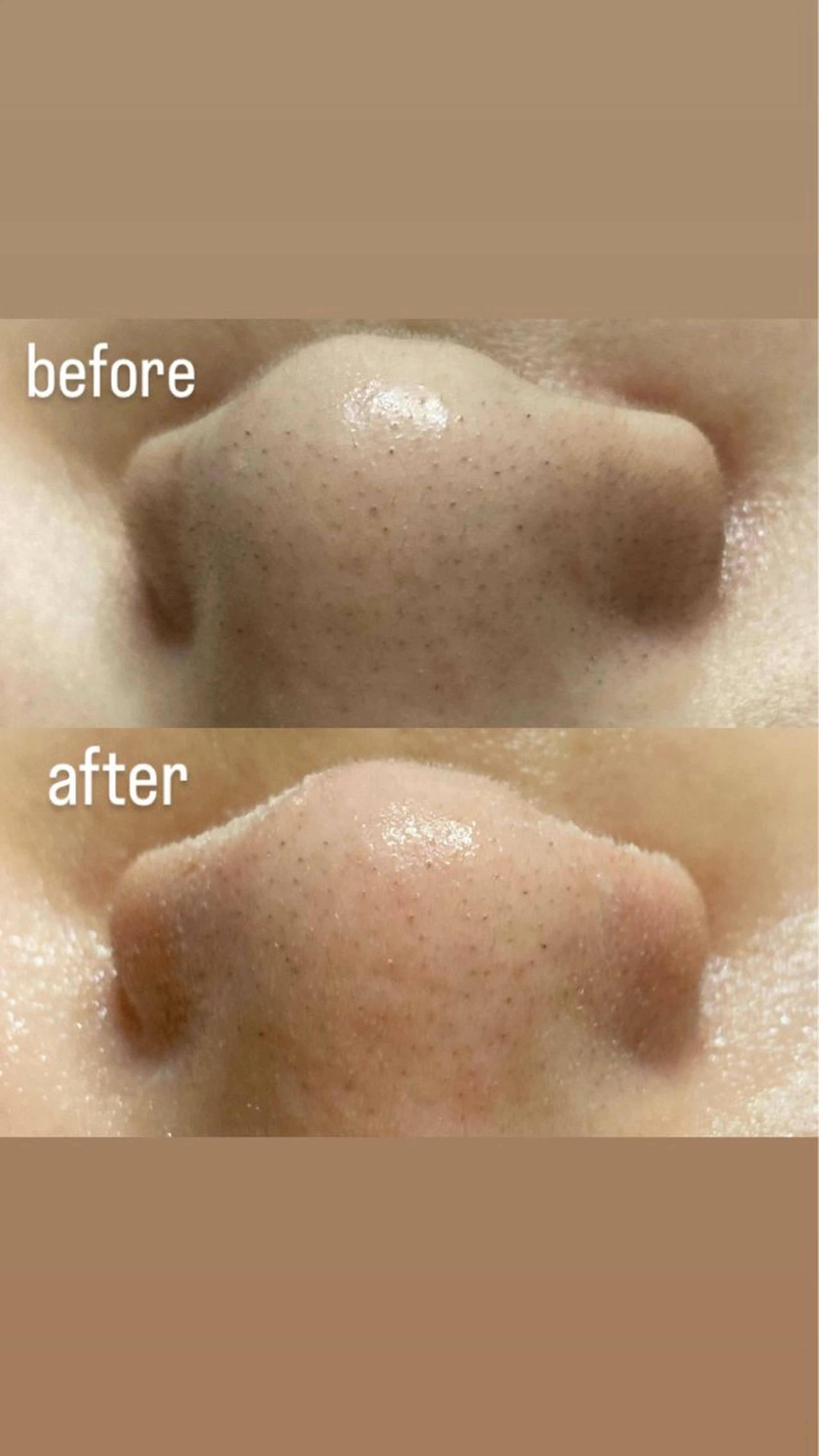 磐田｜LAYLA 一番丁寧な脱毛店のエステ・リラクイメージ