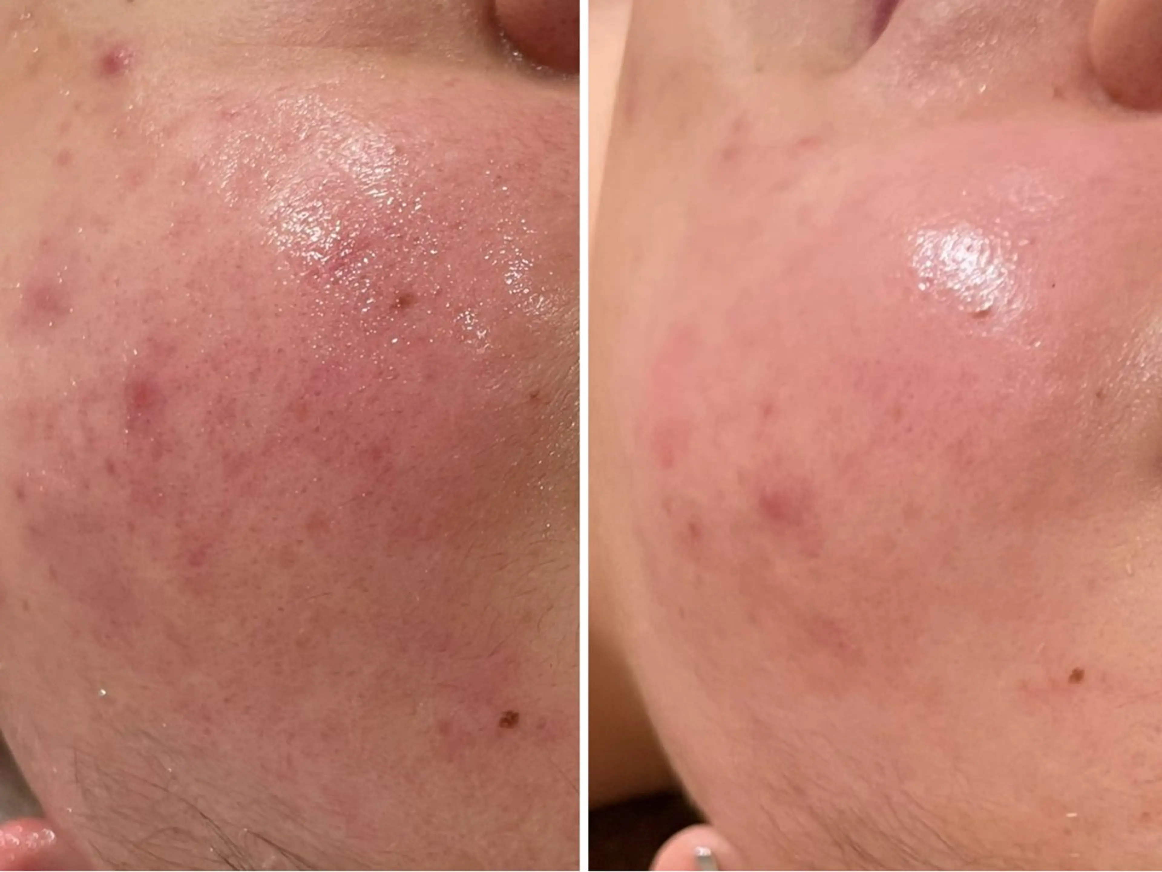 イデアルMe ♡のその他イメージ