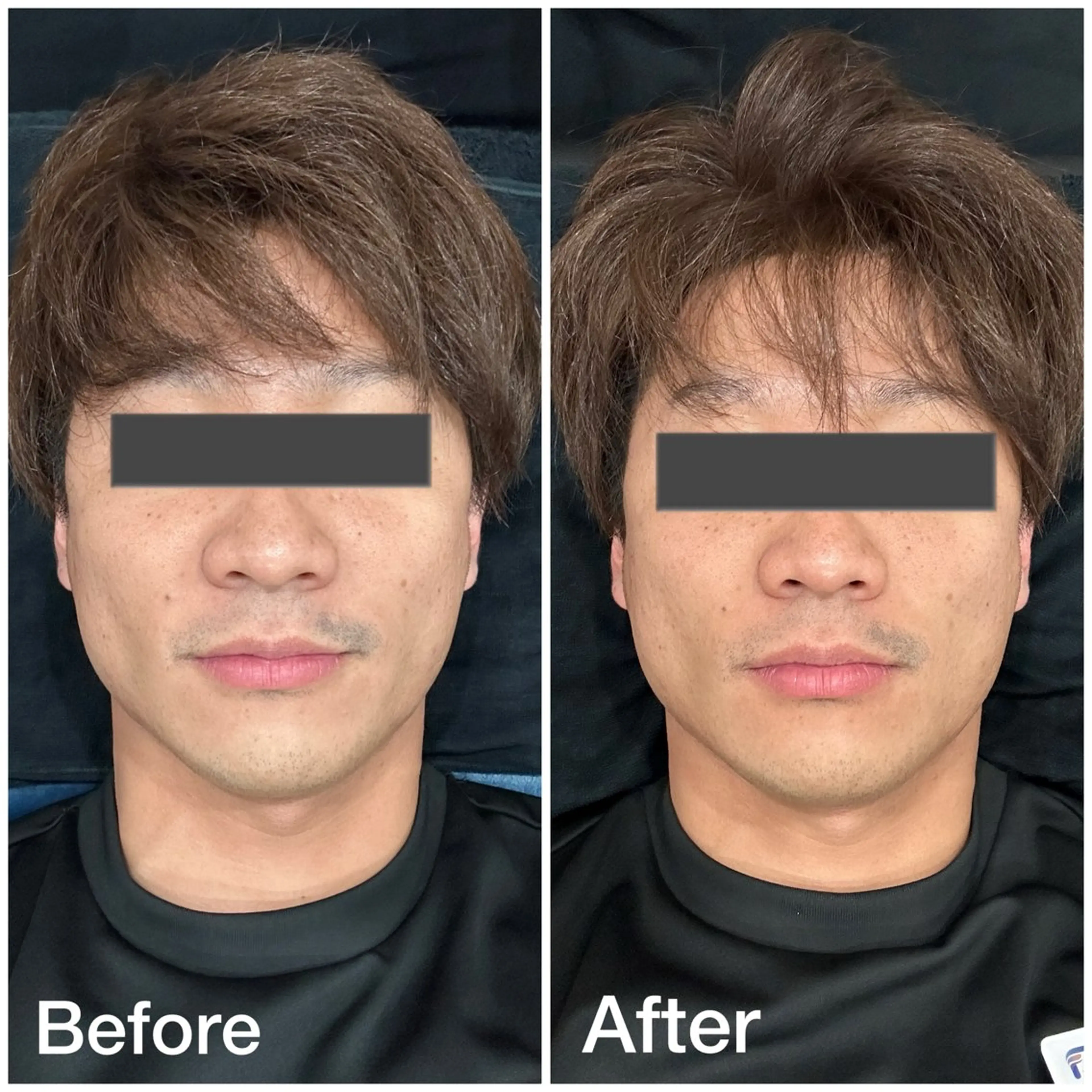 小顔矯正・骨盤矯正 FLOW鍼灸整体院のエステ・リラクイメージ