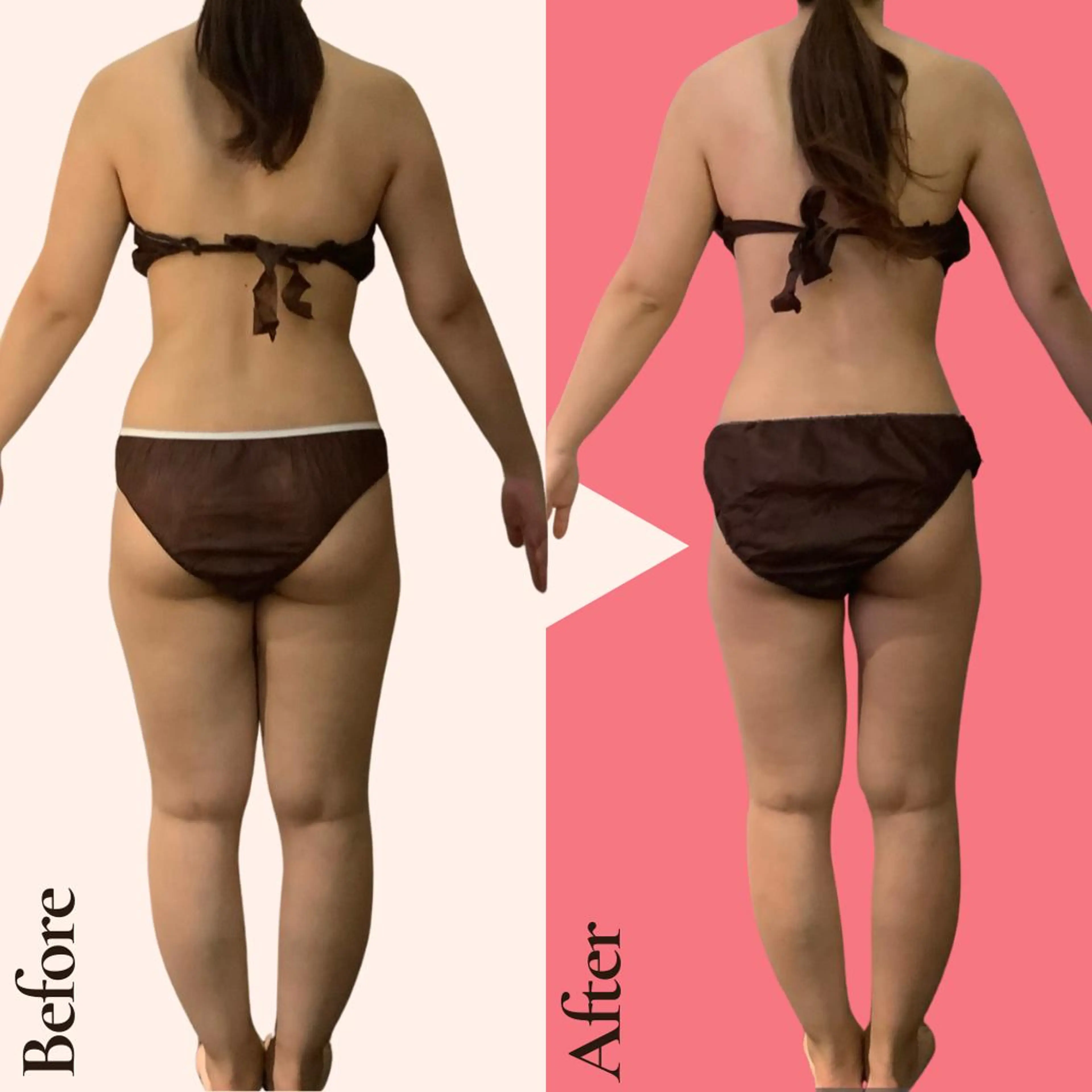 痩身ダイエット専門店 プレシャスのエステ・リラクイメージ