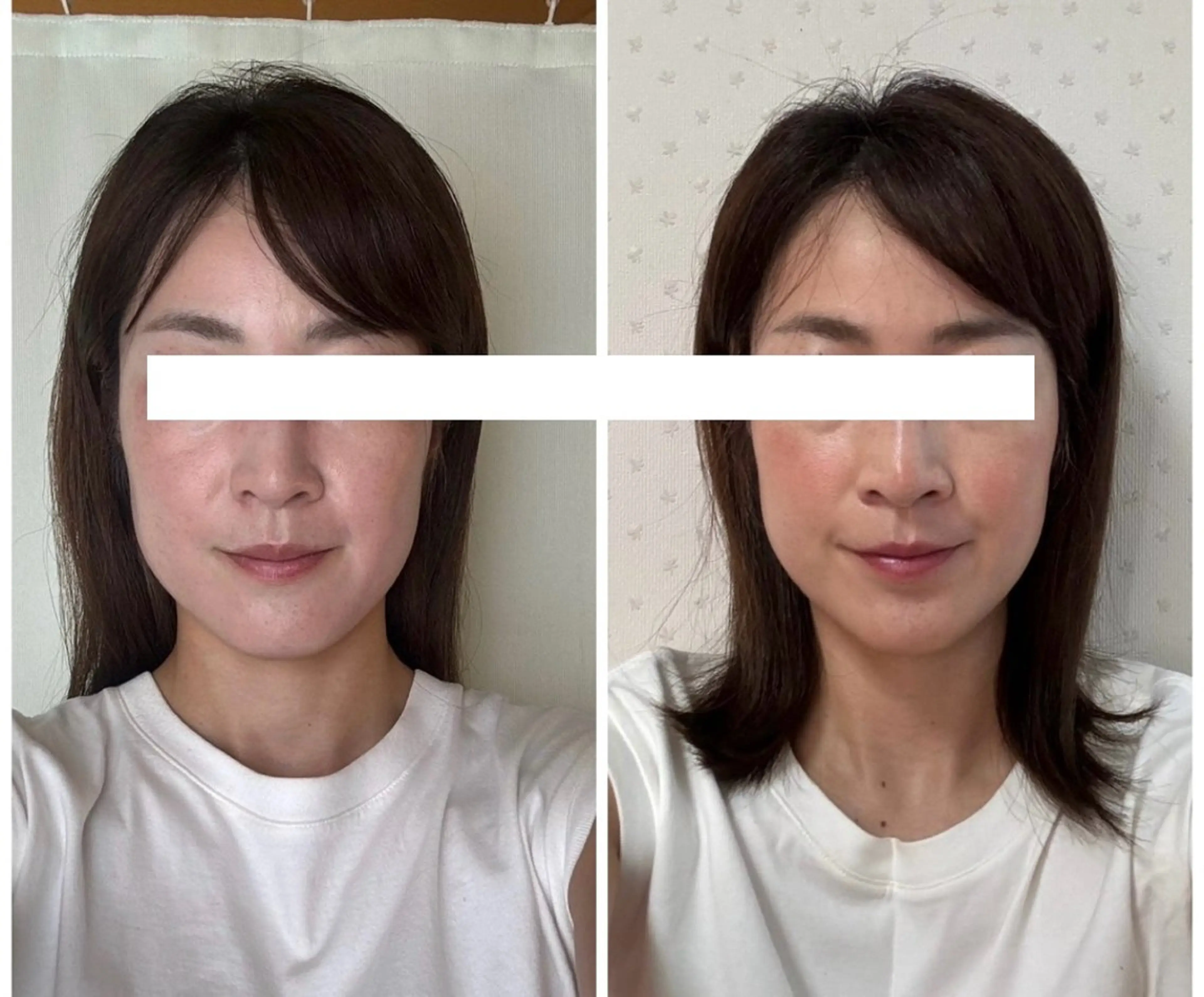 丸顔さんの救世主 高田 くみのエステ・リラクイメージ