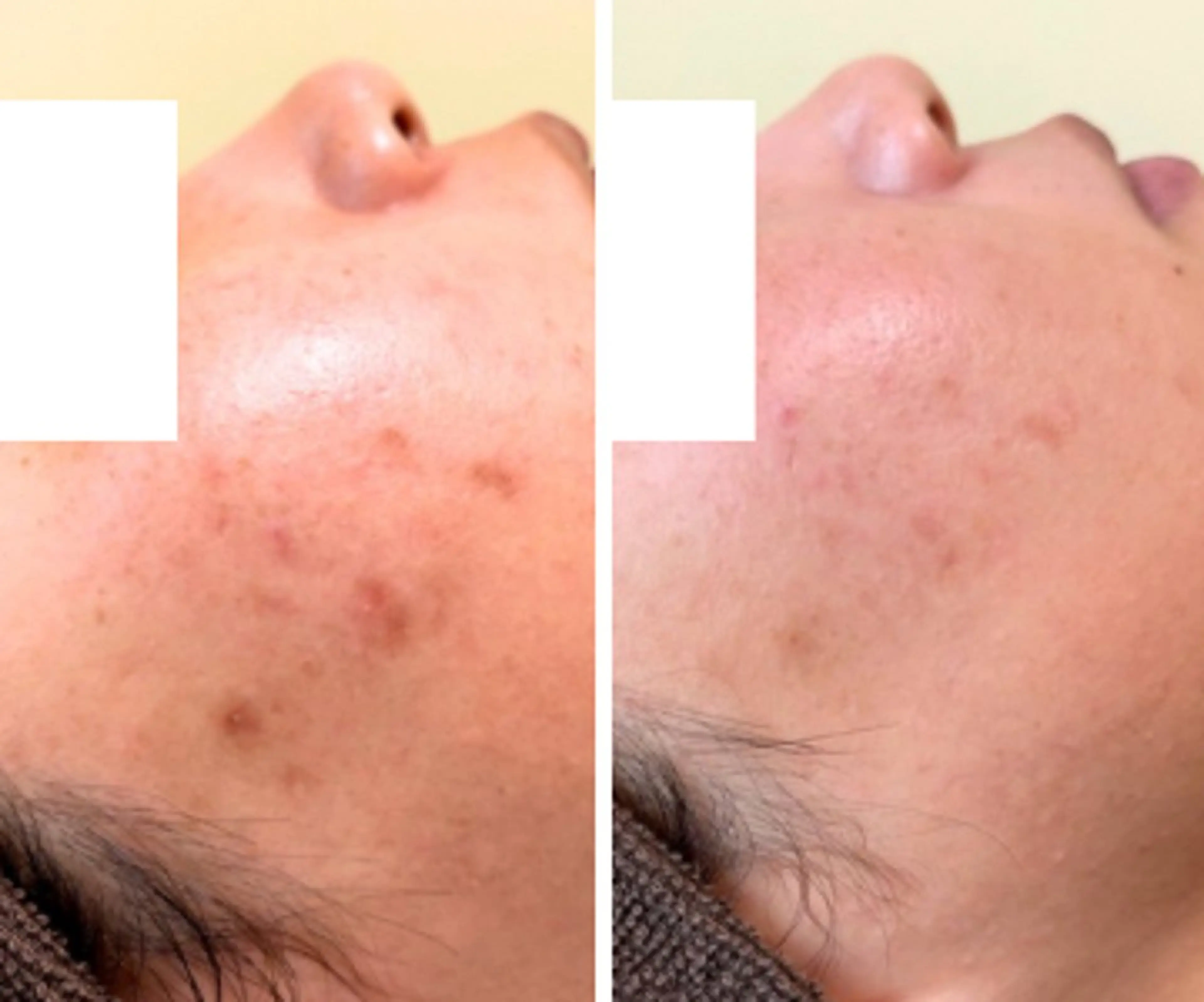 近藤 みさきのエステ・リラクイメージ