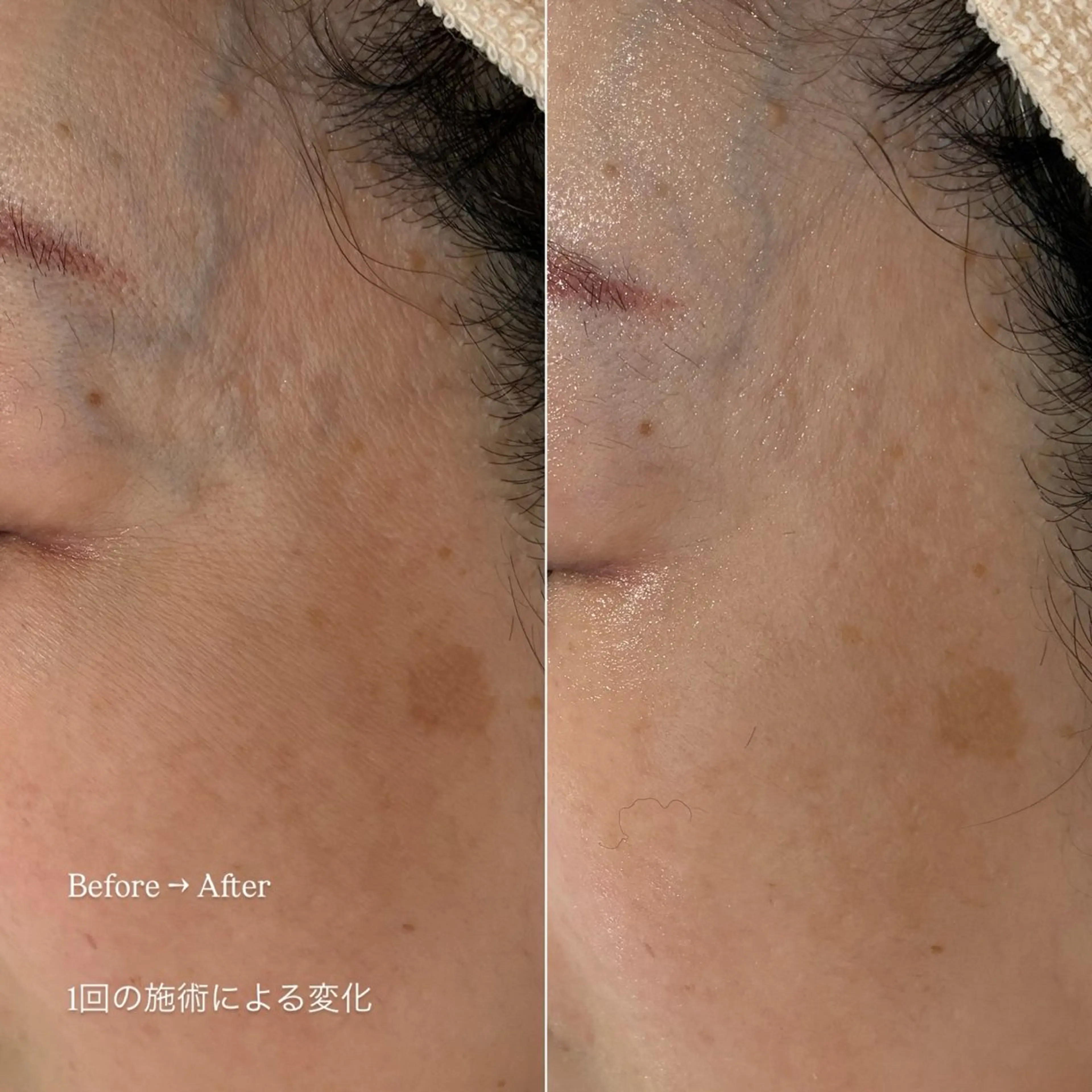 エステ etre - 韓国肌管理 -のエステ・リラクイメージ