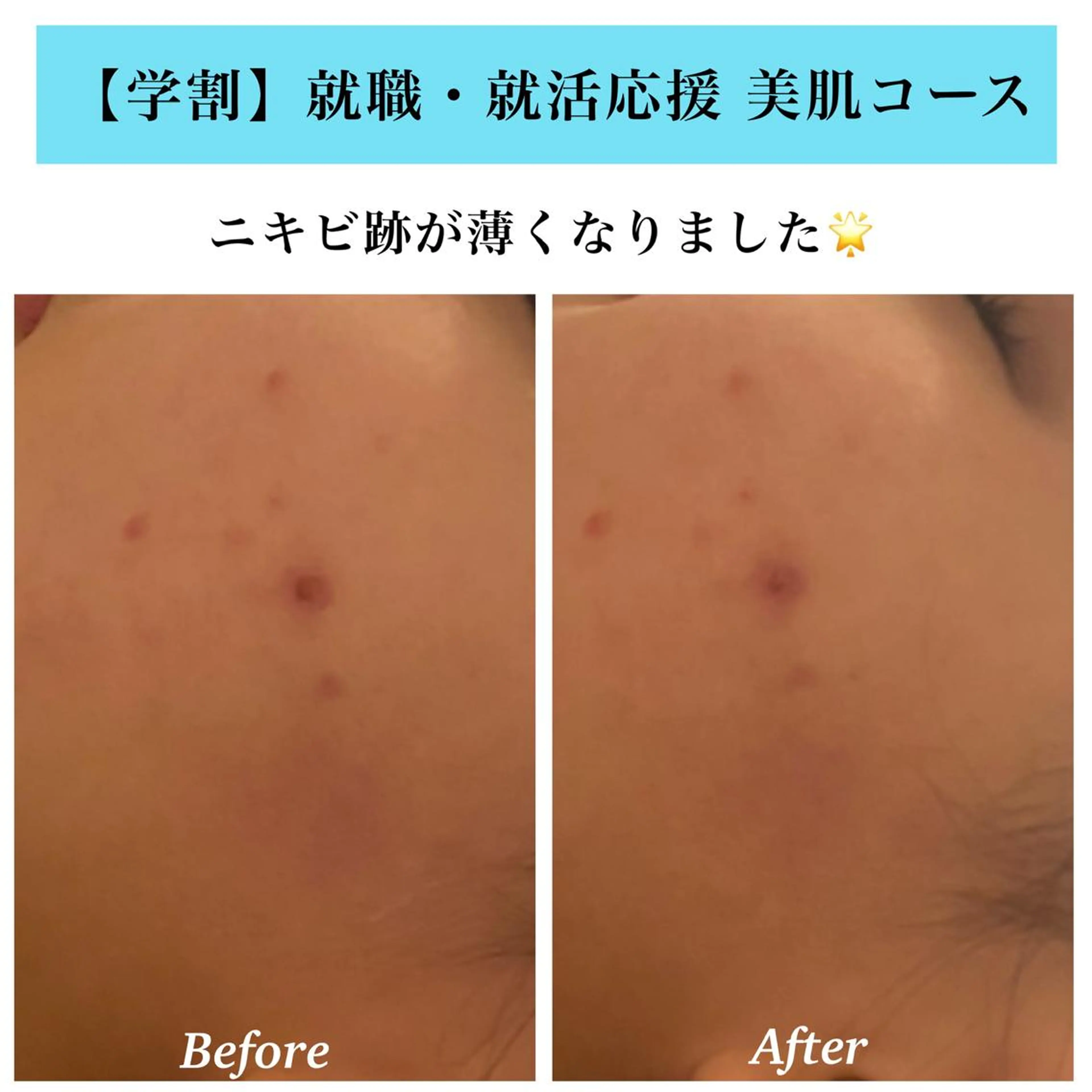 エステ Bellesthe (ベルエステ)のエステ・リラクイメージ