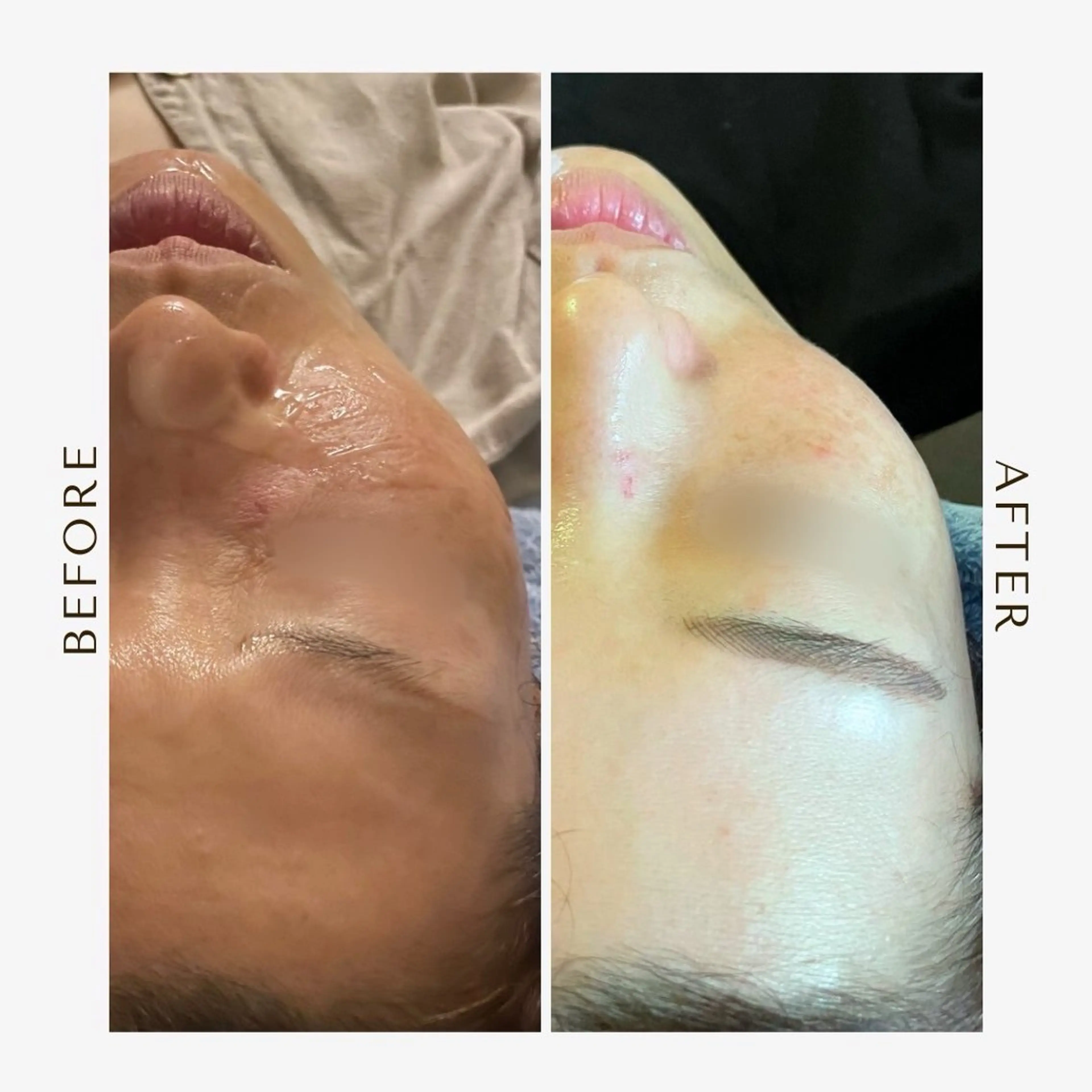 be living 真実のエステ・リラクイメージ