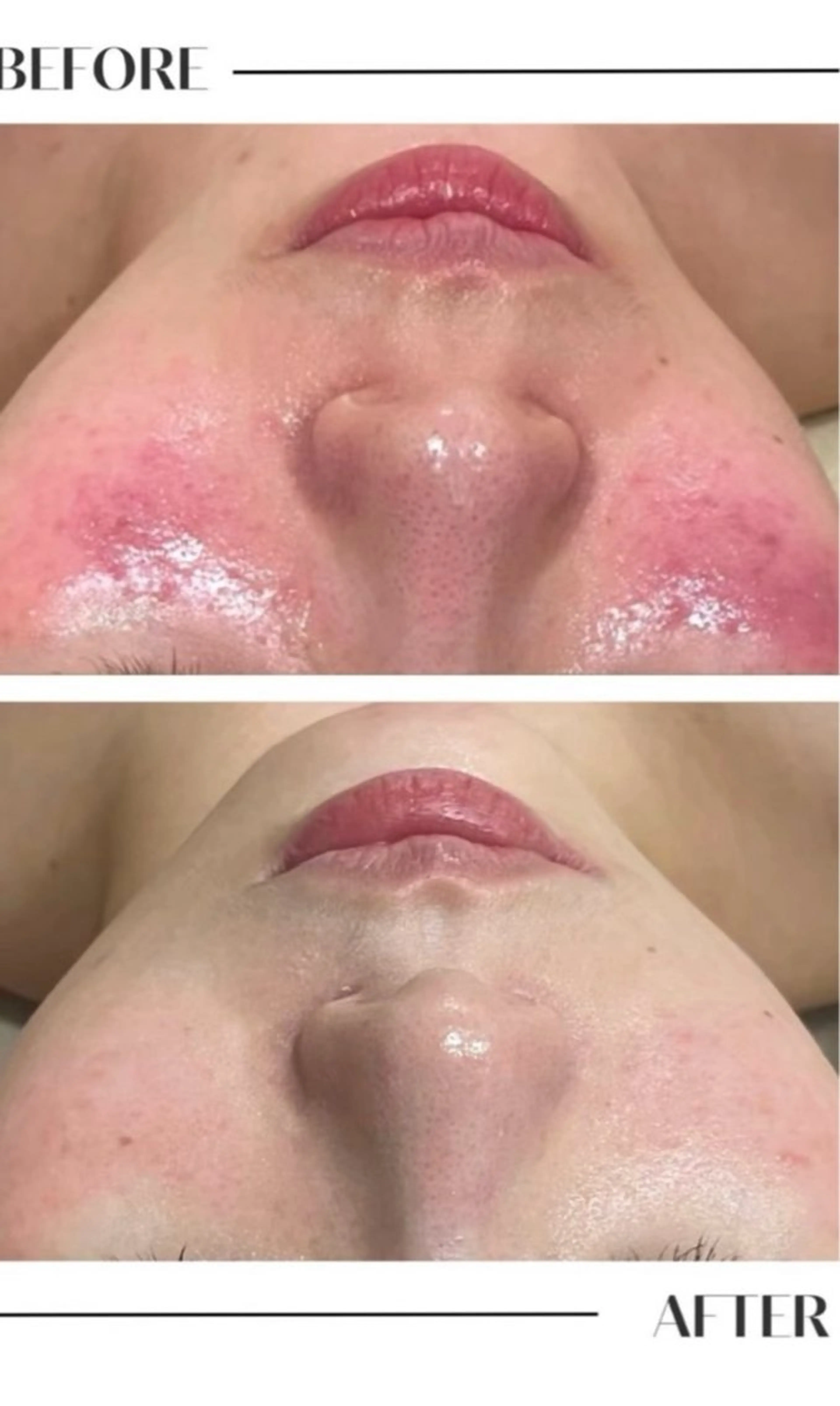 フェイシャル/脱毛 ジョアアンジェ景山のエステ・リラクイメージ