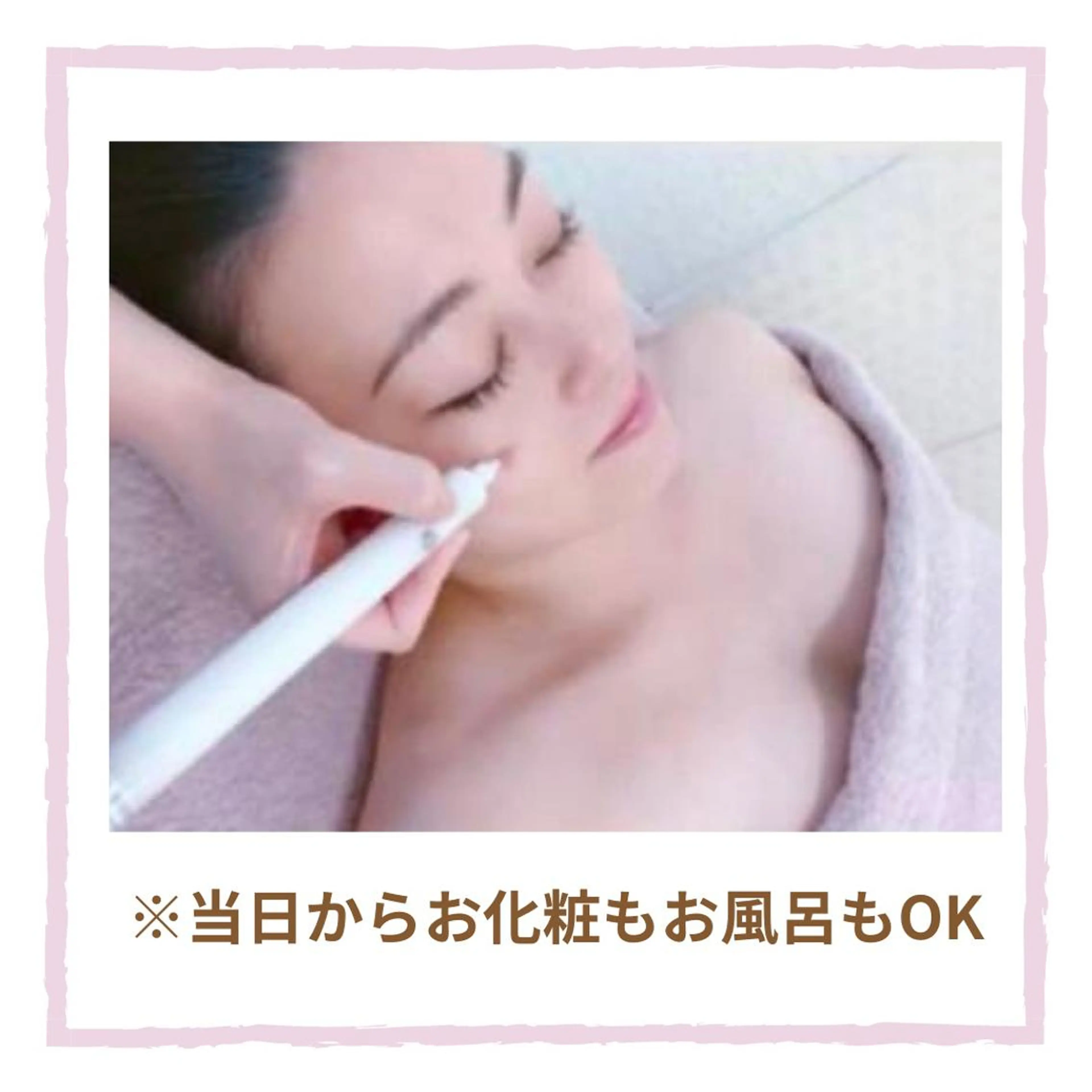 毛穴・シミ専門サロン ルパークのエステ・リラクイメージ