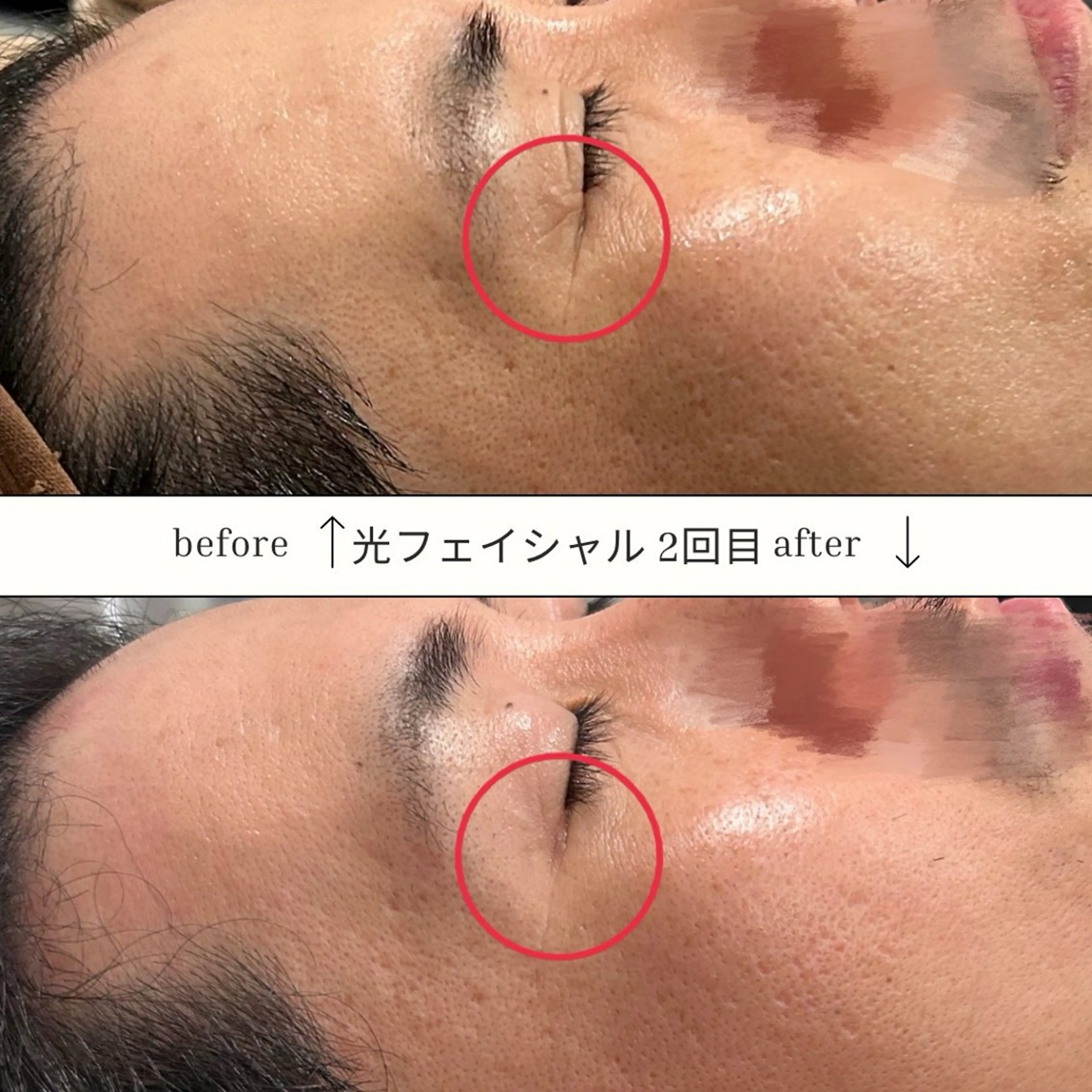 メンズ SKIN GYM メンズ専門脱毛サロンのエステ・リラクイメージ